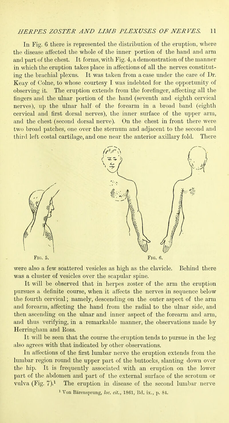 In Fig. 6 there is represented the distribution of the eruption, where the disease affected the whole of the inner portion of the hand and arm and part of the chest. It forms, with Fig. 4, a demonstration of the manner in which the eruption takes place in affections of all the nerves constitut- ing the brachial plexus. It was taken from a case under the care of Dr. Keay of Colne, to whose courtesy I was indebted for the opportunity of observing it. The eruption extends from the forefinger, affecting all the fingers and the ulnar portion of the hand (seventh and eighth cervical nerves), up the ulnar half of the forearm in a broad band (eighth cervical and first dorsal nerves), the inner surface of the upper arm, and the chest (second dorsal nerve). On the chest in front there were two broad patches, one over the sternum and adjacent to the second and third left costal cartilage, and one near the anterior axillary fold. There Fig. 5. Fig. 6. were also a few scattered vesicles as high as the clavicle. Behind there was a cluster of vesicles over the scapular spine. It will be observed that in herpes zoster of the arm the eruption pursues a definite course, when it affects the nerves in sequence below the fourth cervical; namely, descending on the outer aspect of the arm and forearm, affecting the hand from the radial to the ulnar side, and then ascending on the ulnar and inner aspect of the forearm and arm, and thus verifying, in a remarkable manner, the observations made by Herringliam and Koss. It will be seen that the course the eruption tends to pursue in the leg also agrees with that indicated by other observations. In affections of the first lumbar nerve the eruption extends from the lumbar region round the upper part of the buttocks, slanting down over the hip. It is frequently associated with an eruption on the lower part of the abdomen and part of the external surface of the scrotum or vulva (Fig. 7).^ The eruption in disease of the second lumbar nerve