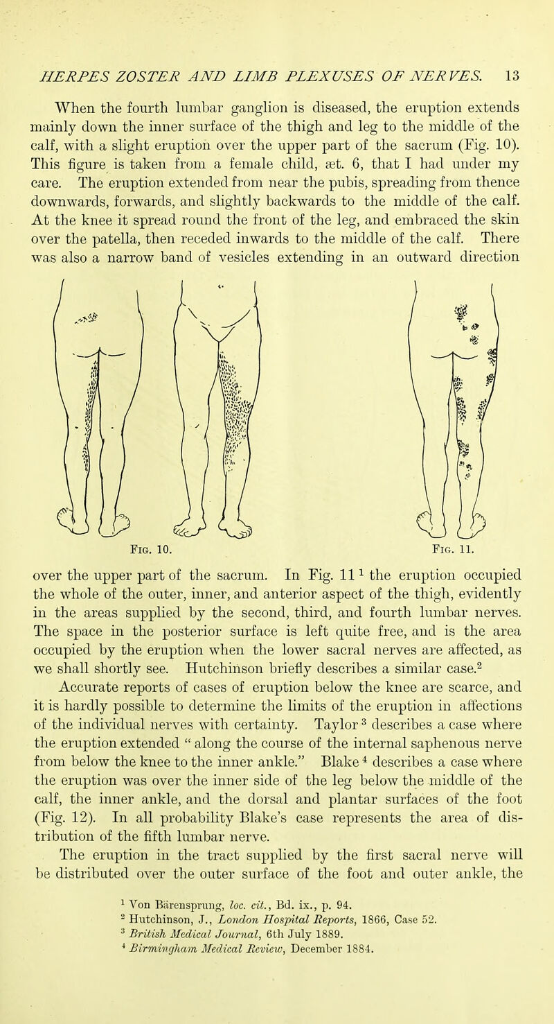 When the fourth huiibar ganglion is diseased, the eruption extends mainly down the inner surface of the thigh and leg to the middle of the calf, with a slight eruption over the upper part of the sacrum (Fig. 10). This figure is taken from a female child, set. 6, that I had under my care. The eruption extended from near the pubis, spreading from thence downwards, forwards, and slightly backwards to the middle of the calf. At the knee it spread round the front of the leg, and embraced the skin over the patella, then receded inwards to the middle of the calf. There was also a narrow band of vesicles extending in an outward direction over the upper part of the sacrum. In Fig. 11^ the eruption occupied the whole of the outer, inner, and anterior aspect of the thigh, evidently in the areas supplied by the second, third, and fourth lumbar nerves. The space in the posterior surface is left quite free, and is the area occupied by the eruption when the lower sacral nerves are affected, as we shall shortly see. Hutchinson briefly describes a similar case.^ Accurate reports of cases of eruption below the knee are scarce, and it is hardly possible to determine the limits of the eruption in affections of the individual nerves with certainty. Taylor ^ describes a case where the eruption extended  along the course of the internal saphenous nerve from below the knee to the inner ankle. Blake * describes a case where the eruption was over the inner side of the leg below the middle of the calf, the inner ankle, and the dorsal and plantar surfaces of the foot (Fig. 12). In all probability Blake's case represents the area of dis- tribution of the fifth lumbar nerve. The eruption in the tract supplied by the first sacral nerve will be distributed over the outer surface of the foot and outer ankle, the Fig. 10. Fig. 11. ^ Von Bareiispvung, lot. cit., Bd. ix., p. 94. - Hutchinson, J., London Hospital Reports, 1866, Case 52. ^ British Medical Journal, 6th July 1889. Birmingham Medical Review, December 1884.