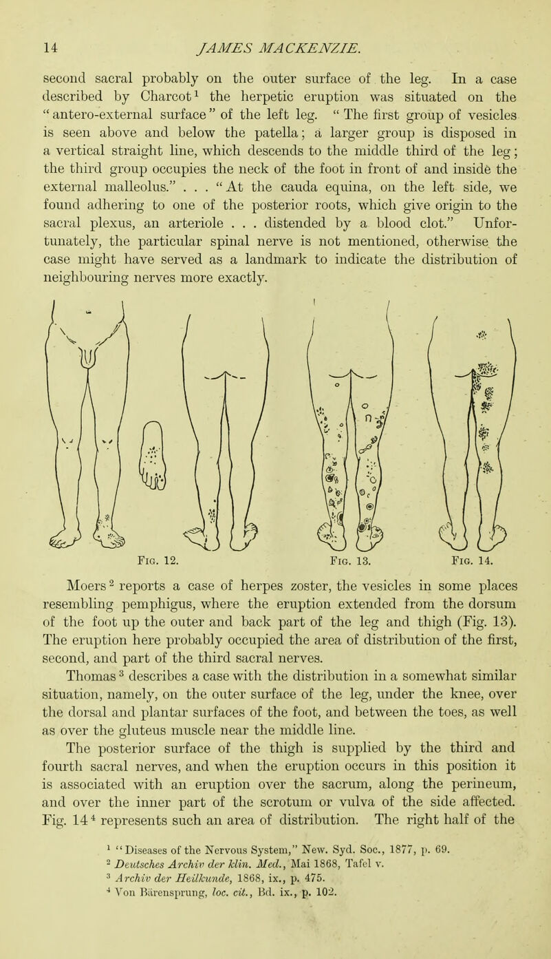 second sacral probably on the outer surface of the leg. In a case described by Charcot^ the herpetic eruption was situated on the  antero-external svirface  of the left leg.  The first group of vesicles is seen above and below the patella; a larger group is disposed in a vertical straight line, which descends to the middle third of the leg; the third group occupies the neck of the foot in front of and inside the external malleolus. ... At the cauda equina, on the left side, we found adhering to one of the posterior roots, which give origin to the sacral plexus, an arteriole . . . distended by a blood clot. Unfor- tunately, the particular spinal nerve is not mentioned, otherwise the case might have served as a landmark to indicate the distribution of neighbouring nerves more exactly. Fig. 12. Fig. 13. Fig. 14. Moers ^ reports a case of herpes zoster, the vesicles in some places resembling pemphigus, where the eruption extended from the dorsum of the foot up the outer and back part of the leg and thigh (Fig. 13). The eruption here probably occupied the area of distribution of the first, second, and part of the third sacral nerves. Thomas ^ describes a case with the distribution in a somewhat similar situation, namely, on the outer surface of the leg, under the knee, over the dorsal and plantar surfaces of the foot, and between the toes, as well as over the gluteus muscle near the middle line. The posterior surface of the thigh is supplied by the third and fourth sacral nerves, and when the eruption occurs in this position it is associated with an eruption over the sacrum, along the perineum, and over the inner part of the scrotum or vulva of the side affected. Fig. 14* represents such an area of distribution. The right half of the * Diseases of the Nervous System, New. Syd. Soc., 1877, p. 69. - Deutsches Archiv der klin. Med., Mai 1868, Tafel v. ' Archiv der Heilkimde, 1868, ix., p. 475. Von Biirensprung, loc. cit., Bd. ix., p. 102.