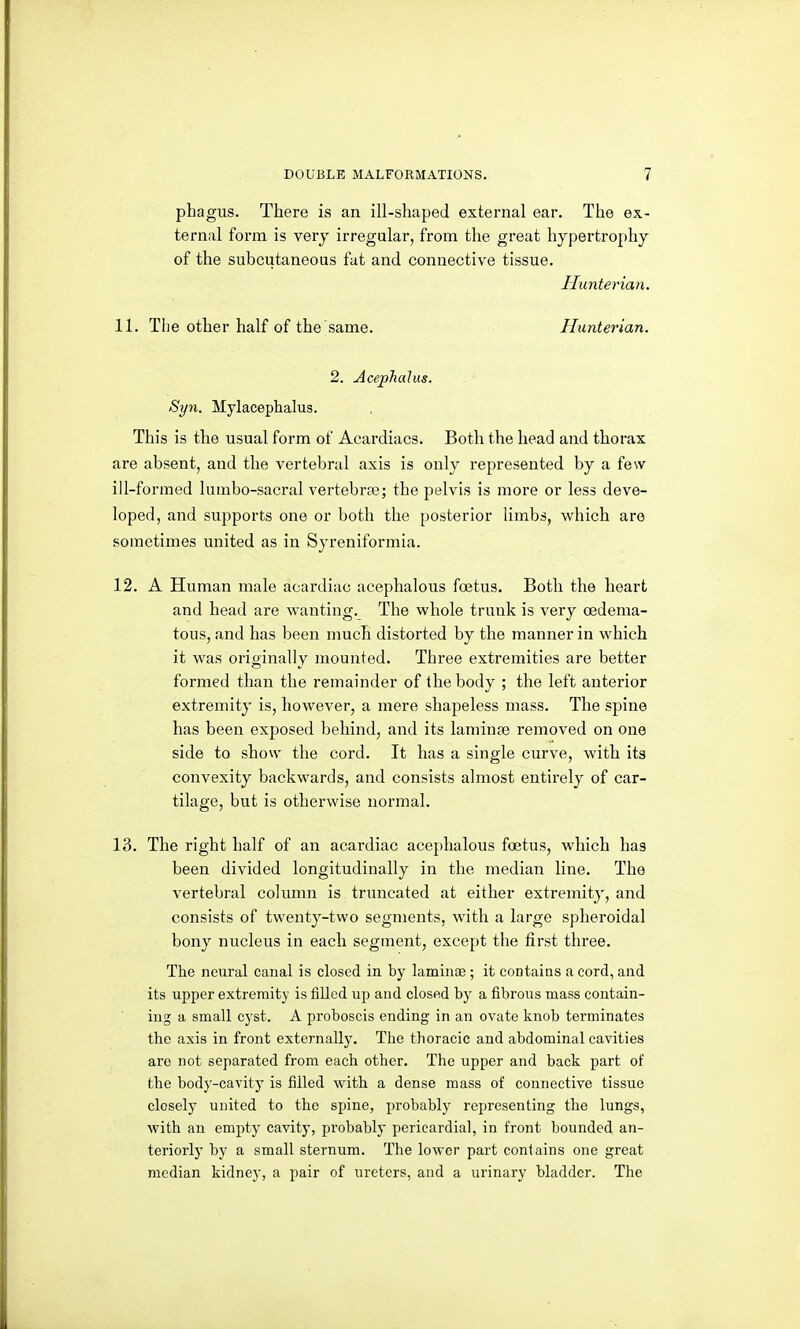 phagus. There is an ill-shaped external ear. The ex- ternal form is very irregular, from the great hypertrophy of the subcutaneous fat and connective tissue. Hunterian. 11. The other half of the same. Hunterian. 2. Acephalus. Syn. Mylaeephalus. This is the usual form of Acardiacs. Both the head and thorax are absent, and the vertebral axis is only represented by a few ill-formed lumbo-sacral vertebrte; the pelvis is more or less deve- loped, and supports one or both the posterior limbs, which are sometimes united as in Syreniformia. 12. A Human male acardiac acephalous foetus. Both the heart and head are wanting. The whole trunk is very (edema- tous, and has been much distorted by the manner in which it was originally mounted. Three extremities are better formed than the remainder of the body ; the left anterior extremity is, however, a mere shapeless mass. The spine has been exposed behind, and its laminse removed on one side to show the cord. It has a single curve, with its convexity backwards, and consists almost entirely of car- tilage, but is otherwise normal. 13. The right half of an acardiac acephalous foetus, which has been divided longitudinally in the median line. The vertebral column is truncated at either extremity, and consists of twenty-two segments, with a large spheroidal bony nucleus in each segment, except the first three. The neural canal is closed in by laminse; it coDtaias a cord, and its upper extremity is filled up and closed by a fibrous mass contain- ing a small cyst. A proboscis ending in an ovate knob terminates the axis in front externally. The thoracic and abdominal cavities are not separated from each other. The upper and back part of the body-cavity is filled with a dense mass of connective tissue closely united to the spine, probably representing the lungs, with an empty cavity, probably pericardial, in front bounded an- teriorlj' by a small stei-num. The lower part contains one great median kidney, a pair of ureters, and a urinary bladder. The