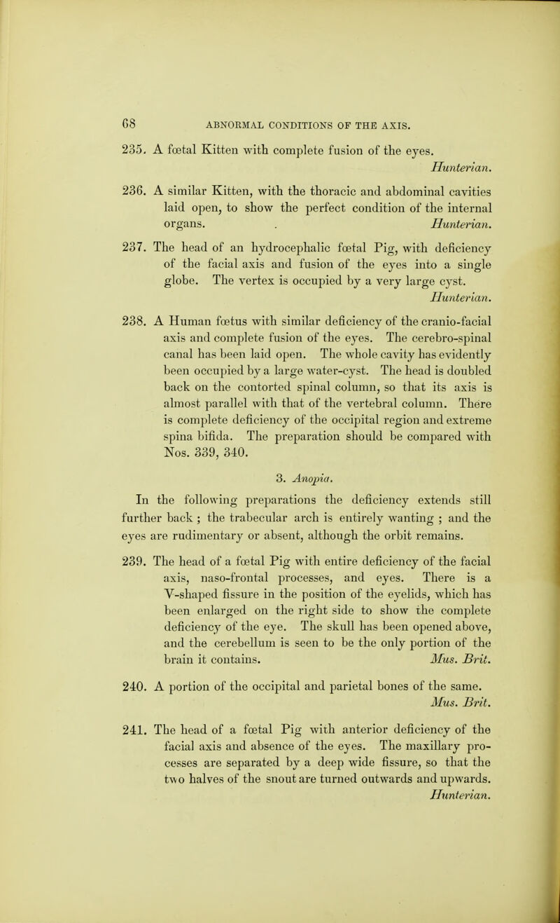 235. A foetal Kitten with complete fusion of the eyes. Hunterian. 236. A similar Kitten, with the thoracic and abdominal cavities laid open, to show the perfect condition of the internal organs. . Hunterian. 237. The head of an hydrocephalic foetal Pig, with deficiency of the facial axis and fusion of the eyes into a single globe. The vertex is occupied by a very large cyst. Hunterian. 238. A Human foetus with similar deficiency of the cranio-facial axis and complete fusion of the eyes. The cerebro-spinal canal has been laid open. The whole cavity has evidently been occupied by a large water-cyst. The head is doubled back on the contorted spinal column, so that its axis is almost parallel with that of the vertebral column. There is complete deficiency of the occipital region and extreme spina bifida. The preparation should be compared with Nos. 339, 340. 3. Anopia, In the following preparations the deficiency extends still further back ; the trabecular arch is entirely wanting ; and the eyes are rudimentary or absent, although the orbit remains. 239. The head of a foetal Pig with entire deficiency of the facial axis, naso-frontal processes, and eyes. There is a V-shaped fissure in the position of the eyelids, which has been enlarged on the right side to show the complete deficiency of the eye. The skull has been opened above, and the cerebellum is seen to be the only portion of the brain it contains. Mus. Brit. 240. A portion of the occipital and parietal bones of the same. Mus. Brit. 241. The head of a foetal Pig with anterior deficiency of the facial axis and absence of the eyes. The maxillary pro- cesses are separated by a deep wide fissure, so that the two halves of the snout are turned outwards and upwards. Hunterian.