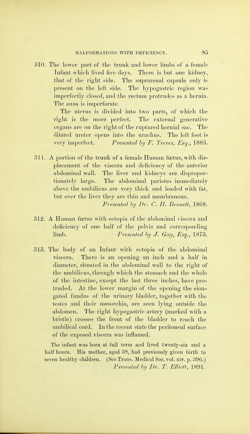 310. The lower part of the trunk and lower limbs of a female Infant v^ llich lived five days. There is but one kidney, that of the right side. The suprarenal capsule only is present on the left side. The hypogastric region v\'as imperfectly closed, and the rectum protrudes as a hernia. The anus is imperforate. The uterus is divided into two parts, of which the right is the more perfect. The external generative organs are on the right of the ruptured hernial sac. The dilated ureter opens into the urachus. The left foot is very imperfect. Presented by F. Treves, Esq., 1883. 311. A portion of the trunk of a female Human foetus, with dis- placement of the viscera and deficiency of the anterior abdominal wall. The liver and kidneys are dispropor- tionately large. The abdominal parietes immediately above the umbilicus are very thick and loaded with fat, but over the liver they are thin and membranous. Presented by Dr. C. H. Bennett, 1868. 312. A Human foetus with ectopia of the abdominal viscera and deficiency of one half of the pelvis and corresponding- limb. Presented by J. Gay, Esq., 1873. 313. The body of an Infant with ectopia of the abdominal viscera. There is an opening an inch and a half in diameter, situated in the abdominal wall to the right of the umbilicus, through which the stomach and the whole of the intestine, except the last three inches, have pro- truded. At the lower margin of the opening the elon- gated fundus of tlie urinary bladder, together with the testes and their mesorchia, are seen lying outside the abdomen. The right hypogastric artery (marked with a bristle) crosses the front of the bladder to reach the umbilical cord. In the recent state the peritoneal surface of the exposed viscera was inflamed. The infant was born at fuU term and lived twentj'-six and a half hours. His mother, aged 38, had previously given birth to seven healthy children. (Sec Trans. Medical Soc. vol. xiv. p. 396.) Presented by Dr. T. Elliott, 181)1.
