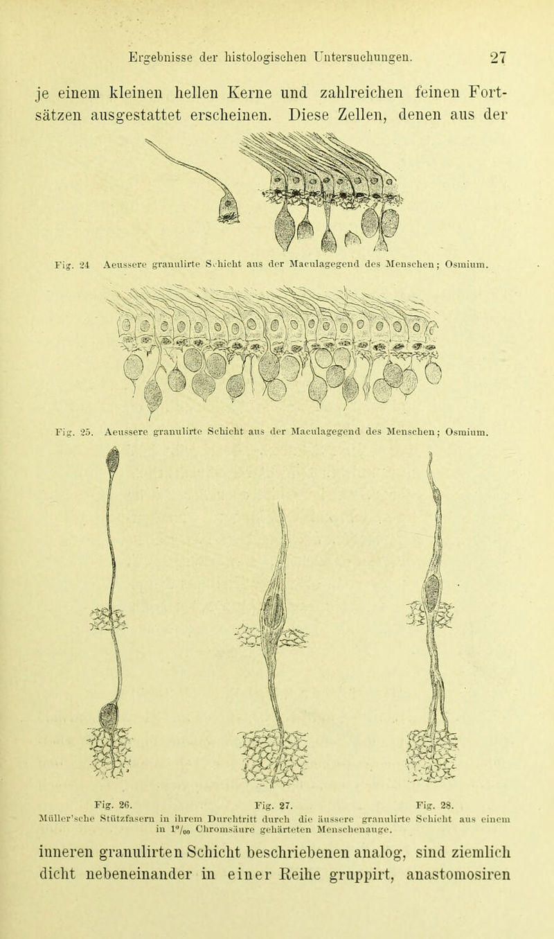 je einem kleinen hellen Kerne und zahlreichen feinen Fort- sätzen ausgestattet erscheinen. Diese Zellen, denen aus der Fig. 24 Aeussere granulirte Sfhieht aus der Maculagegend des Menschen; Osmium. Fig. 25. Aeussere granulirte Schicht aus der Maculagegend des Menschen; Osmium. Fig. 26. Fig. 27. Fig. 28. Müller'sche Stützfasern in ihrem Durchtritt durch die äussere granulirte Schicht aus einem in 1/00 Chromsäure gehärteten Menschenauge. inneren granulirten Schicht beschriebenen analog, sind ziemlich dicht nebeneinander in einer Eeihe gruppirt, anastomosiren