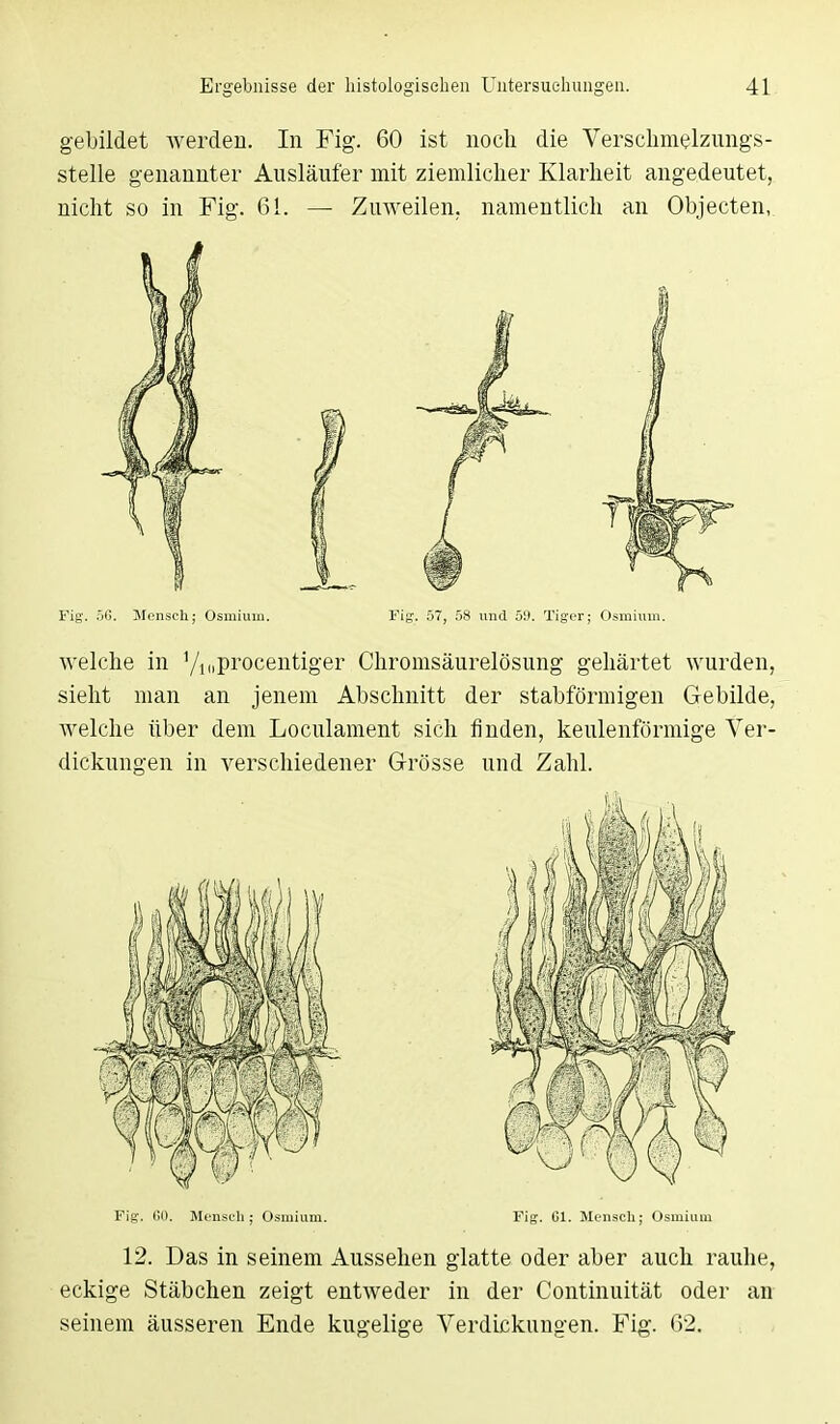 gebildet werden. In Fig. 60 ist noch die Verschmelzungs- stelle genannter Ausläufer mit ziemlicher Klarheit angedeutet, nicht so in Fig. 61. — Zuweilen, namentlich an Objecten, Fig. 5G. Mensch; Osmium. Fig. 57, 58 und 59. Tiger; Osmium. welche in '/mprocentiger Chromsäurelösung gehärtet wurden, sieht man an jenem Abschnitt der stabförmigen Gebilde, welche über dem Loculament sich finden, keulenförmige Ver- dickungen in verschiedener Grösse und Zahl. Fig. GO. Mensch; Osmium. Fig. Gl. Mensch; Osmium 12. Das in seinem Aussehen glatte oder aber auch rauhe, eckige Stäbchen zeigt entweder in der Continuität oder an seinem äusseren Ende kugelige Verdickungen. Fig. 62.