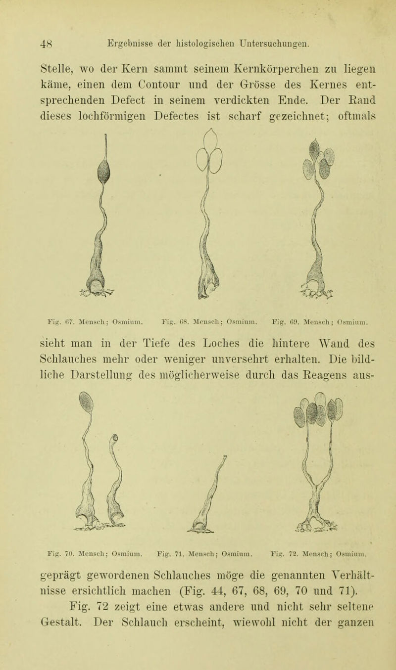 Stelle, wo der Kern sammt seinem Kernkörperchen zu liegen käme, einen dem Contour und der Grösse des Kernes ent- sprechenden Defect in seinem verdickten Ende. Der Rand dieses lochförmigen Defectes ist scharf gezeichnet; oftmals Fig. il7. Mensch; Osmium. Fig. 68. Mensch; Osmium. Fig. 69. Mensch; Osmium. sieht man in der Tiefe des Loches die hintere Wand des Schlauches mehr oder weniger unversehrt erhalten. Die bild- liche Darstellung des möglicherweise durch das Reagens aus- Fig. 70. Mensch; Osmium. Fig. 71. Mensch; Osmium. Fig. Vi. Mensch; Osmium. geprägt gewordenen Schlauches möge die genannten Verhält- nisse ersichtlich machen (Fig. 44, 67, 68, 69, 70 und 71). Fig. 72 zeigt eine etwas andere und nicht sehr seltene G estalt. Der Schlauch erscheint, wiewohl nicht der ganzen