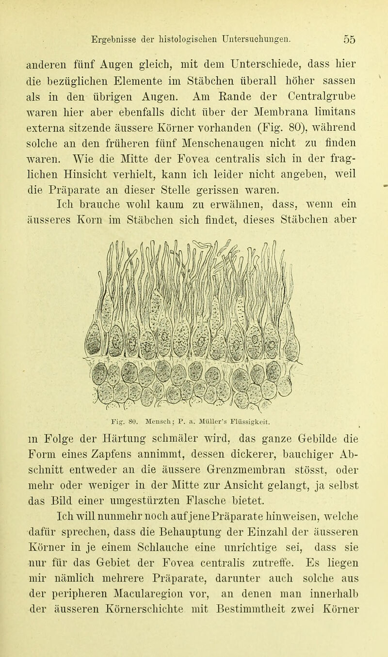 anderen fünf Augen gleich, mit dem Unterschiede, dass hier die bezüglichen Elemente im Stäbchen überall höher sassen als in den übrigen Augen. Am Eande der Centraigrube waren hier aber ebenfalls dicht über der Membrana limitans externa sitzende äussere Körner vorhanden (Fig. 80), während solche an den früheren fünf Menschenaugen nicht zu finden waren. Wie die Mitte der Fovea centralis sich in der frag- lichen Hinsicht verhielt, kann ich leider nicht angeben, weil die Präparate an dieser Stelle gerissen waren. Ich brauche wohl kaum zu erwähnen, dass, wenn ein äusseres Korn im Stäbchen sich findet, dieses Stäbchen aber Fig. 80. Mensch; P. a. Müller's Flüssigkeit. m Folge der Härtung schmäler wird, das ganze Gebilde die Form eines Zapfens annimmt, dessen dickerer, bauchiger Ab- schnitt entweder an die äussere Grenzmembran stösst, oder mehr oder weniger in der Mitte zur Ansicht gelangt, ja selbst das Bild einer umgestürzten Flasche bietet. Ich will nunmehr noch auf jene Präparate hinweisen, welche dafür sprechen, dass die Behauptung der Einzahl der äusseren Körner in je einem Schlauche eine unrichtige sei, dass sie nur für das Gebiet der Fovea centralis zutreffe. Es liegen mir nämlich mehrere Präparate, darunter auch solche aus der peripheren Macularegion vor, an denen man innerhalb der äusseren Körnerschichte mit Bestimmtheit zwei Körner