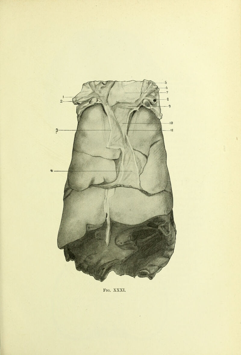 Fig. XXXI.