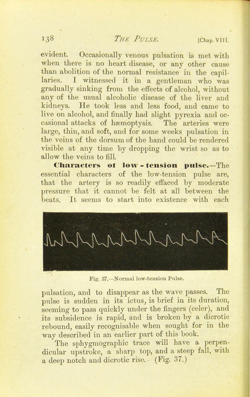 evident. Occasionally venous pulsation is met with when there is no heart disease, or any other cause than abolition of the normal resistance in the capil- laries. I witnessed it in a gentleman who was gradually sinking from the effects of alcohol, without any of the usual alcoholic disease of the liver and kidneys. He took less and less food, and came to live on alcohol, and finally had slight pyrexia and oc- casional attacks of haemoptysis. The arteries were large, thin, and soft, and for some weeks pulsation in the veins of the dorsum of the hand could be rendered visible at any time by dropping the wrist so as to allow the veins to fill. Characters oi low - tension pulse.— The essential characters of the low-tension pulse are, that the artery is so readily effaced by moderate pressure that it cannot be felt at all between the beats. It seems to start into existence with each Fig. 37.—Normal low-tension Pulse. pulsation, and to disappear as the wave passes. The pulse is sudden in its ictus, is brief in its duration, seeming to pass quickly under the fingers (celer), and its subsidence is rapid, and is broken by a dicrotic rebound, easily recognisable when sought for in the way described in an earlier part of this book. The sphygmographic trace will have a perpen- dicular upstroke, a sharp top, and a steep fall, with a deep notch and dicrotic rise. • (Fig. 37.)