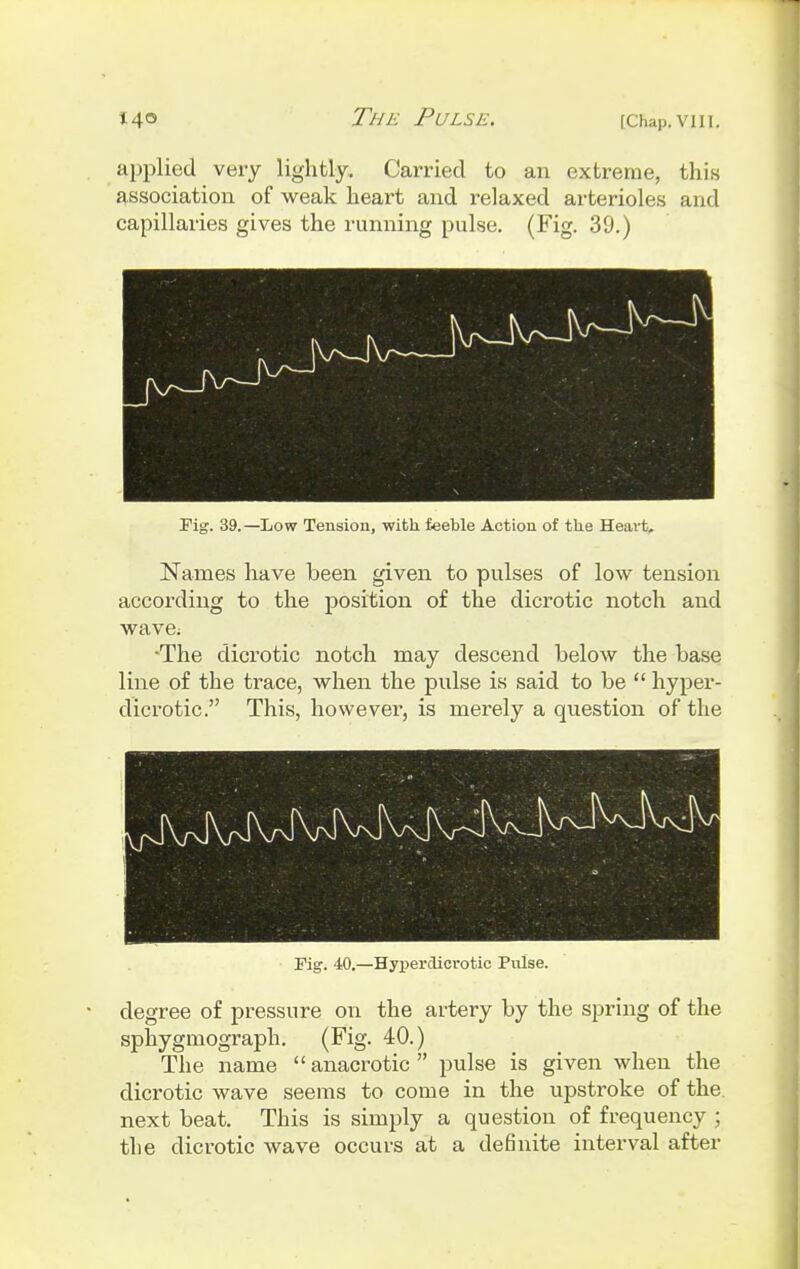 applied very lightly. Carried to an extreme, this association of weak heart and relaxed arterioles and capillaries gives the running pulse. (Fig. 39.) Fig. 39.—Low Tension, with feeble Action of the Heart. Names have been given to pulses of low tension according to the position of the dicrotic notch and wave; •The dicrotic notch may descend below the base line of the trace, when the pulse is said to be  hyper- dicrotic. This, however, is merely a question of the Fig. 40.—Hyperclicrotic Pulse. degree of pressure on the artery by the spring of the sphygmograph. (Fig. 40.) The name anacrotic pulse is given when the dicrotic wave seems to come in the upstroke of the next beat. This is simply a question of frequency ; the dicrotic wave occurs at a definite interval after