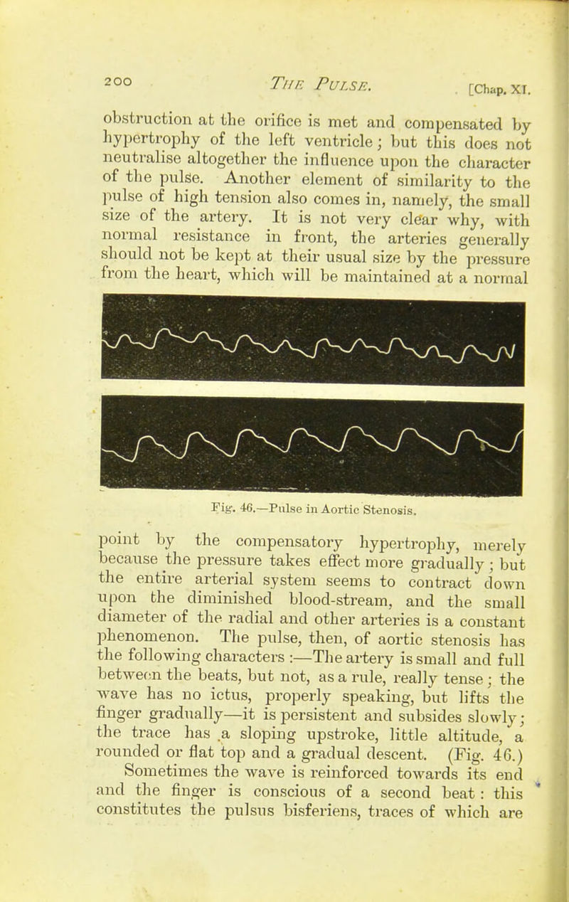 [Chap. XI. obstruction at the orifice is met and compensated by hypertrophy of the left ventricle; but this does not neutralise altogether the influence upon the character of the pulse. Another element of similarity to the pulse of high tension also comes in, namely, the small size of the artery. It is not very clear why, with normal resistance in front, the arteries generally should not be kept at their usual size by the pressure from the heart, which will be maintained at a normal Fig-. 46.—Pulse in Aortic Stenosis. point by the compensatory hypertrophy, merely because the pressure takes effect more gradually ; but the entire arterial system seems to contract down upon the diminished blood-stream, and the small diameter of the radial and other arteries is a constant phenomenon. The pulse, then, of aortic stenosis has the following characters :—The artery is small and full between the beats, but not, as a rule, really tense; the wave has no ictus, properly speaking, but lifts the finger gradually—it is persistent and subsides slowly; the trace has a sloping upstroke, little altitude, a rounded or flat top and a gradual descent. (Fig. 46.) Sometimes the wave is reinforced towards its end and the finger is conscious of a second beat : this constitutes the pulsus bisferiens, traces of which are