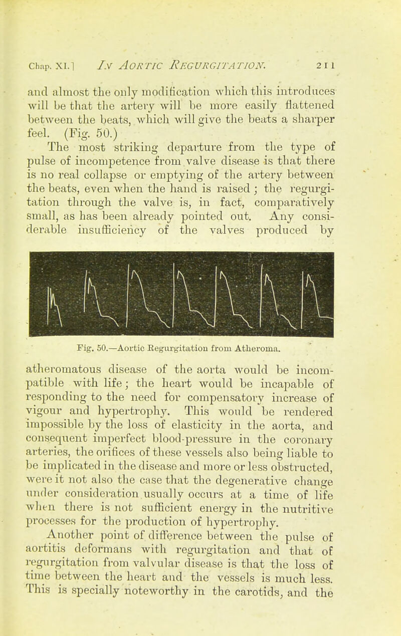 and almost the only modification which this introduces will be that the artery will be more easily flattened between the beats, which will give the beats a sharper feel. (Fig. 50.) The most striking departure from the type of pulse of incompetence from valve disease is that there is no real collapse or emptying of the artery between the beats, even when the hand is raised ; the regurgi- tation through the valve is, in fact, comparatively small, as has been already pointed out. Any consi- derable insufficiency of the valves produced by Fig. 50.—Aortic Regurgitation from Atheroma. atheromatous disease of the aorta would be incom- patible with life; the heart would be incapable of responding to the need for compensatory increase of vigour and hypertrophy. This would be rendered impossible by the loss of elasticity in the aorta, and consequent imperfect blood-pressure in the coronary arteries, the orifices of these vessels also being liable to be implicated in the disease and more or less obstructed, were it not also the case that the degenerative change under consideration usually occurs at a time of life when there is not sufficient energy in the nutritive processes for the production of hypertrophy. Another point of difference between the pulse of aortitis deformans with regurgitation and that of regurgitation from valvular disease is that the loss of time between the heart and the vessels is much less. This is specially noteworthy in the carotids, and the