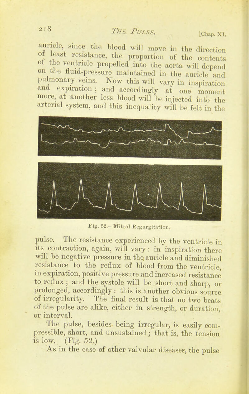 auricle since the blood will move in the direction or least resistance, the proportion of the contents or the ventricle propelled. into the aorta will depend on the fluid-pressure maintained in the auricle and pulmonary veins. Now this will vary in inspiration and expiration; and accordingly at one moment more, at another less blood will be injected into the arterial system, and this inequality will be felt in the Tig. 52.—Mitral Regurgitation. pulse. The resistance experienced by the ventricle in its contraction, again, will vary: in inspiration there will be negative pressure in the, auricle and diminished resistance to the reflux of blood from the ventricle, in expiration, positive pressure and increased resistance to reflux; and the systole will be short and sharp, or prolonged, accordingly : this is another obvious source of irregularity. The final result is that no two beats of the pulse are alike, either in strength, or duration, or interval. The pulse, besides, being irregular, is easily com- pressible, short, and unsustained; that is, the tension is low. (Fig. 52,) As in the case of other valvular diseases, the pulse