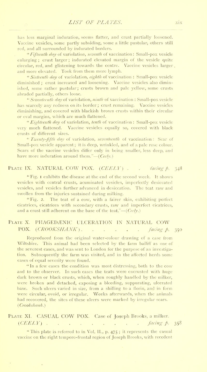 has less marginal induration, seems flatter, and crust partially loosened. Vaccine vesicles, some partly subsiding, some a little pustular, others still red, and all surrounded by indurated borders.  Fifteenth day of variolation, seventh of vaccination : Small-pox vesicle enlarging ; crust larger; indurated elevated margin of the vesicle quite circular, red, and glistening towards the centre. Vaccine vesicles larger, and more elevated. Took from them more lymph. Sixteenth day of variolation, eighth of vaccination : Small-pox vesicle diminished ; crust increased and loosening. Vaccine vesicles also dimin- ished, some rather pustular; crusts brown and pale yellow, some crusts abraded partially, others loose.  Scveiilei ntli lYfTy of variolation, nintli of vaccination : Small-pox vesicle has scarcely any redness on its border; crust remaining. Vaccine vesicles diminishing, and covered with blackish brown crusts A\ithin their circular or oval margins, which are much llattened.  Eighteenth day of variolation, tenth of vaccination : Small-pox vesicle very much flattened. Vaccine vesicles equally so, covered with black crusts of different sizes.  Twcnty-fiftli day of variolation, scvcntcentli of vaccination : Scar of Small-pox vesicle apparent; it is deep, wrinkled, and of a pale rose colour. Scars of the vaccine vesicles differ only in being smaller, less deep, and have more induration around them.—(Certv.) Plate IX. NATURAL COW POX. (CEELY) . . Iariu<i p. 348  Fig. I c,\hibits the disease at the end of the second week. It shows vesicles with central crusts, acuminated vesicles, imperfectly desiccated vesicles, and vesicles further advanced in desiccation. The teat raw and swollen from the injuries sustained during milking. Fig. 2. The teat of a cow, with a fairer skin, exhibiting perfect cicatrices, cicatrices with secondary crusts, raw and imperfect cicatrices, and a crust still adherent on the base of the teat.—(Or/v.) Plate X. PHAGEDiENIC ULCERATION IN Ny\TURAL COW POX. (CROOKSHAXK) faa/ii; p. 350 Reproduced from the original water-colour drawing of a case from Wiltshire. This animal had been selected by the farm bailiff' as one of the severest cases, and was sent to London for the purpose of an investiga- tion. Subsequently the farm was visited, and in the affected herds some cases of equal severity were found. In a few cases the condition was most distressing, both to the cow and to the observer. In such cases the teats were encrusted with huge dark brown or black crusts, which, when roughly handled by the milker, were broken and detached, exposing a bleeding, suppurating, ulcerated base. Such ulcers varied in size, from a shilling to a florin, and in form were circular, ovoid, or irregular. Weeks afterwards, when the animals had recovered, the sites of these ulcers were marked by irregular scars. (Civo/.'s/iaid,\) Plate XI. CASUAL COW POX. Case of Joseph Brooks, a milker. (CEELY) M''>g P- 358  This plate is referred to in Vol. II., p. 475 ; it l epresents the casual vaccine on the right temporo-frontal region of Joseph Brooks, with recedent
