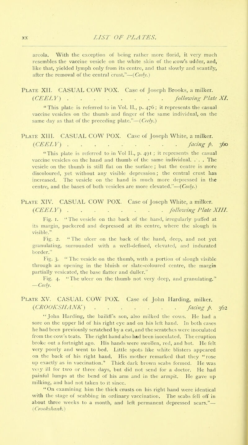 areola. With the exception of being rather more florid, it very much resembles the vaccine vesicle on the white skin of the icow's udder, and, like that, yielded lymph only from its centre, and that slowly and scantily, after the removal of the central crust.—(Ceely.) Plate XII. CASUAL COW POX. Case of Joseph Brooks, a milker. (CEELY) following Plate XL  This plate is referred to in Vol. II., p. 476; it represents the casual vaccine vesicles on the thumb and finger of the same individual, on the same As^y as that of the preceding plate.—(Cccly.) Plate XIII. CASUAL COW POX. Case of Joseph White, a milker. {CEELY) facing p. 360 This plate is referred to in Vol II., p. 491 ; it represents the casual vaccine vesicles on the hand and thumb of the same individual. . . . The vesicle on the thumb is still flat on the surface ; but the centre is more discoloured, yet without any visible depression; the central crust has increased. The vesicle on the hand is much more depressed in the centre, and the bases of both vesicles are more elevated.—(Cecly.) Plate XIV. CASUAL COW POX. Case of Joseph White, a milker. (CEELY) following Plate XIIL Fig. I. The vesicle on the back of the hand, irregularly puffed at its margin, puckered and depressed at its centre, where the slough is visible. Fig. 2.  The ulcer on the back of the hand, deep, and not yet granulating, surrounded with a well-defined, elevated, and indurated border. Fig. 3.  The vesicle on the thumb, with a portion of slough visible through an opening in the bluish or slate-coloured centre, the margin partially vesicated, the base flatter and duller. Fig. 4. The ulcer on the thumb not very deep, and granulating. —Cccly. Plate XV. CASUAL COW POX. Case of John Harding, milker. {CROOKSILiNK) faci?ig p. 362 John Harding, the bailiff's son, also milked the cows. He had a sore on the upper lid of his right eye and on his left hand. In both cases he had been previously scratched by a cat, and the scratches were inoculated from the cow's teats. The right hand also had been inoculated. The eruption broke out a fortnight ago. His hands were swollen, red, and hot. He felt very poorly and went to bed. Little spots like white blisters appeared on the back of his right hand. His mother remarked that they rose up exactly as in vaccination. Thick dark brown scabs formed. He was veiy ill for two or three days, but did not send for a doctor. He had painful lumps at the bend of his arm and in the armpit. He gave up milking, and had not taken to it since.  On examining him the thick crusts on his right hand were identical with the stage of scabbing in ordinary vaccination. The scabs fell off in about three weeks to a month, and left permanent depressed scars.— (Cronkshaiik.)