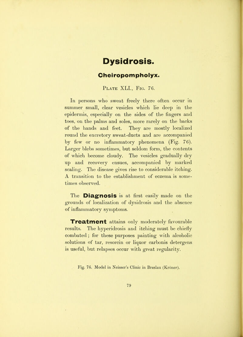 Dysidrosis Cheiropompholyx. Plate XLL, Fig. 76. In persons who sweat freely there often occur in summer small, clear vesicles which lie deep in the epidermis, especially on the sides of the fingers and toes, on the palms and soles, more rarely on the backs of the hands and feet. They are mostly localized round the excretory sweat-ducts and are accompanied by few or no inflammatory phenomena (Fig. 76). Larger blebs sometimes, but seldom form, the contents of which become cloudy. The vesicles gradually dry up and recovery ensues, accompanied by marked scaling. The disease gives rise to considerable itching. A transition to the establishment of eczema is some- times observed. The Diagnosis is at first easily made on the grounds of localization of dysidrosis and the absence of inflammatory symptoms. Treatment attains only moderately favourable results. The hyperidrosis and itching must be chiefly combated ; for these purposes painting with alcoholic solutions of tar, resorcin or liquor carbonis detergens is useful, but relapses occur with great regularity. Fig. 76. Model in Neisser's Clinic in Breslau (Kroner).