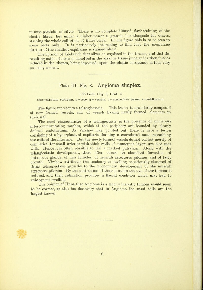 minute particles of silver. There is no complete diffused, dark staining of the elastic fibres, but under a higher power a granule lies alongside the others, staining the whole collection of fibres black. In the figure this is to be seen in some parts only. It is particularly interesting to find that the membrana elastica of the smallest capillaries is stained black. The opinion of Liebreich that silver is oxydised in the tissues, and that the resulting oxide of silver is dissolved in the alkaline tissue juice and is then further reduced in the tissues, being deposited upon the elastic substance, is thus very probably correct. Plate III. Fig. 8. Angioma simplex. X 85 Leitz, Obj. 3, Ocul. 3. . strc = stratum corneum, r = rete, g = vessels, b = connective tissue, i = infiltration. The figure represents a telangiectasis. This lesion is essentially composed of new formed vessels, and of vessels having newly formed elements in their wall. The chief characteristic of a telangiectasis is the presence of numerous intercommunicating meshes, which at the periphery are bounded by clearly defined endothelium. As Virchow has pointed out, there is here a lesion consisting of a hyperplasia of capillaries forming a convoluted mass resembling the coils of the intestine. But the newly formed vessels do not consist merely of capillaries, for small arteries with thick walls of numerous layers are also met with. Hence it is often possible to feel a marked pulsation. Along with the telangiectatic development, there often occurs an abundant formation of cutaneous glands, of hair follicles, of musculi arrectores pilorum, and of fatty growth. Virchow attributes the tendency to swelling occasionally observed of these telangiectatic growths to the pronounced development of the musculi arrectores pilorum. By the contraction of these muscles the size of the tumour is reduced, aiad their relaxation produces a flaccid condition which may lead to subsequent swelling. The opinion of Unna that Angioma is a wholly inelastic tumour would seem to be correct, as also his discovery that in Angioma the mast cells are the largest known.