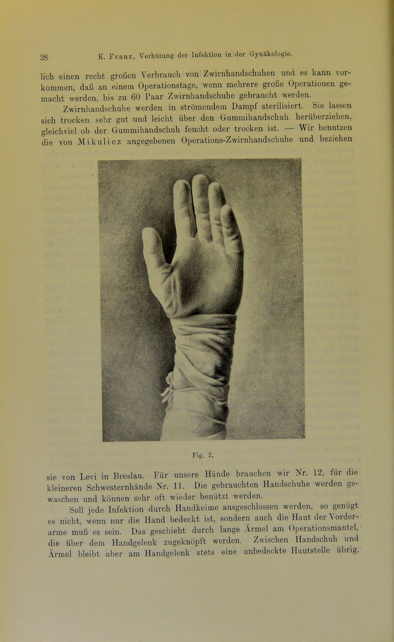 lieh einen recht großen Verbrauch von Zwirnhandschuhen und es kann vor- kommen, daß an einem Operationstage, wenn mehrere große Operationen ge- macht werden, bis zu 60 Paar Zwirnhandschuhe gebraucht werden. Zwirnhandschuhe werden in strömendem Dampf sterilisiert. Sie lassen sich trocken sehr gut und leicht über den Gummihandschuh herüberziehen, gleichviel ob der Gummihandschuh feucht oder trocken ist. — Wir benutzen die von Mikulicz angegebenen Operations-Zwirnhandschuhe und beziehen Fig. 2. sie von Levi in Breslau. Für unsere Hände brauchen wir Nr. 12, für die kleineren Schwesternhände Nr. 11. Die gebrauchten Handschuhe werden ge- waschen und können sehr oft wieder benützt werden. Soll jede Infektion durch Handkeime ausgeschlossen werden, so genügt es nicht, wenn nur die Hand bedeckt ist, sondern auch die Haut der Vorder- arme muß es sein. Das geschieht durch lange Ärmel am Operationsmantel die über dem Handgelenk zugeknöpft werden. Zwischen Handschuh und Ärmel bleibt aber am Handgelenk stets eine unbedeckte Hautstelle übrig.