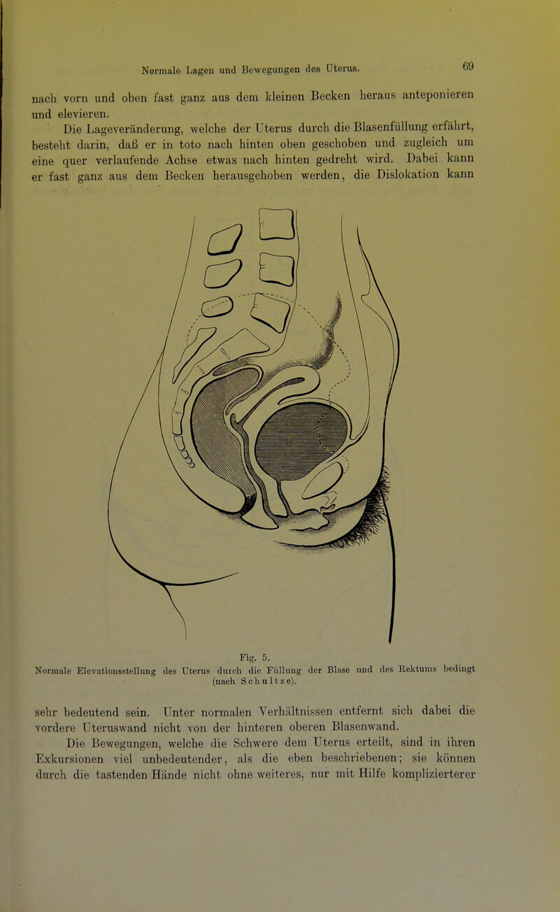 nach vorn und oben fast ganz aus dem kleinen Becken heraus anteponieren und elevieren. Die Lageveränderung, welche der Uterus durch die Blasenfüllung erfährt, besteht darin, daß er in toto nach hinten oben geschoben und zugleich um eine quer verlaufende Achse etwas nach hinten gedreht wird. Dabei kann er fast ganz aus dem Becken herausgehoben werden, die Dislokation kann Fig. 5. Normale Elevationsstellung des Uterus durch die Füllung der Blase und des Kektums bedingt (nach Schultze). sehr bedeutend sein. Unter normalen Verhältnissen entfernt sich dabei die vordere Uteruswand nicht von der hinteren oberen Blasenwand. Die Bewegungen, welche die Schwere dem Uterus erteilt, sind in ihren Exkursionen viel unbedeutender, als die eben beschriebenen; sie können durch die tastenden Hände nicht ohne weiteres, nur mit Hilfe komplizierterer