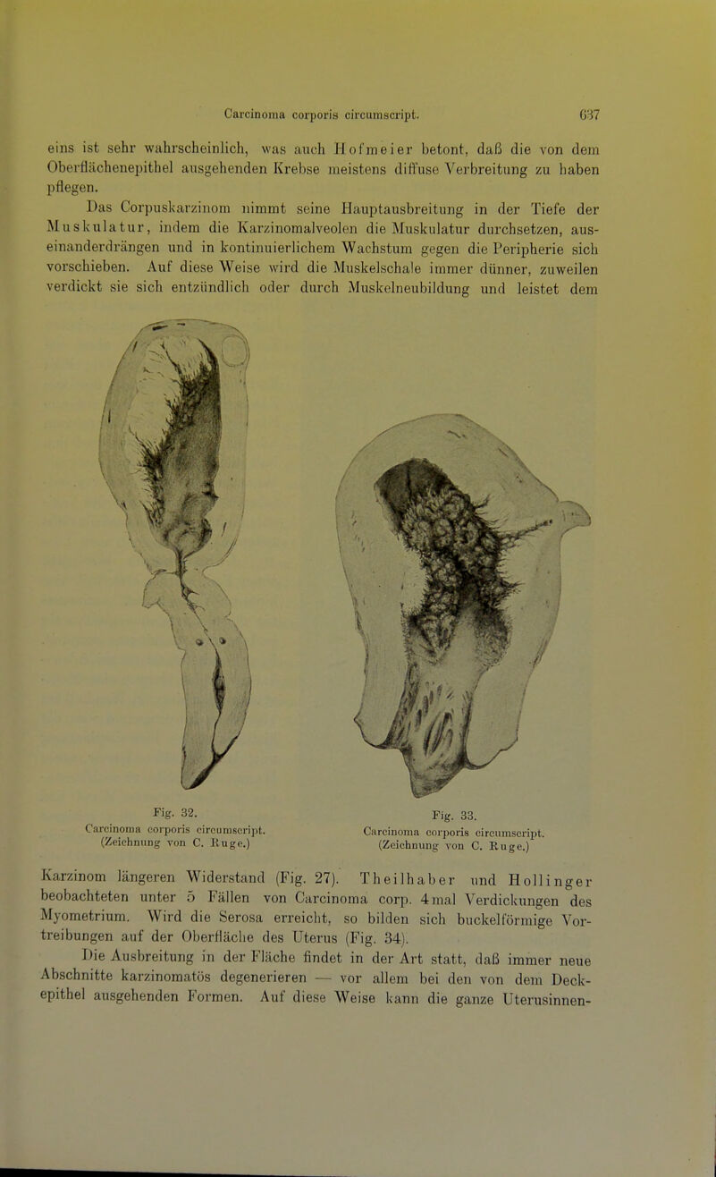 eins ist sehr wahrscheinlich, was auch Hofmeier betont, daß die von dem Oberflächenepithel ausgehenden Krebse meistens diffuse Verbreitung zu haben pflegen. Das Corpuskarzinom nimmt seine Hauptausbreitung in der Tiefe der Muskulatur, indem die Karzinomalveolen die Muskulatur durchsetzen, aus- einanderdrängen und in kontinuierlichem Wachstum gegen die Peripherie sich vorschieben. Auf diese Weise wird die Muskelschale immer dünner, zuweilen verdickt sie sich entzündlich oder durch Muskelneubildung und leistet dem Fig. 32. Fig. 33. Carcinoma corporis circumscript. Carcinoma corporis circumscript. (Zeichnung von C. Kuge.) (Zeichnung von C. Euge.) Karzinom längeren Widerstand (Fig. 27). Theilhaber und Hollinger beobachteten unter 5 Fällen von Carcinoma corp. 4 mal Verdickungen des Myometrium. Wird die Serosa erreicht, so bilden sich buckeiförmige Vor- treibungen auf der Oberfläche des Uterus (Fig. 34). Die Ausbreitung in der Fläche findet in der Art statt, daß immer neue Abschnitte karzinoraatös degenerieren — vor allem bei den von dem Deck- epithel ausgehenden Formen. Auf diese Weise kann die ganze Uterusinnen-