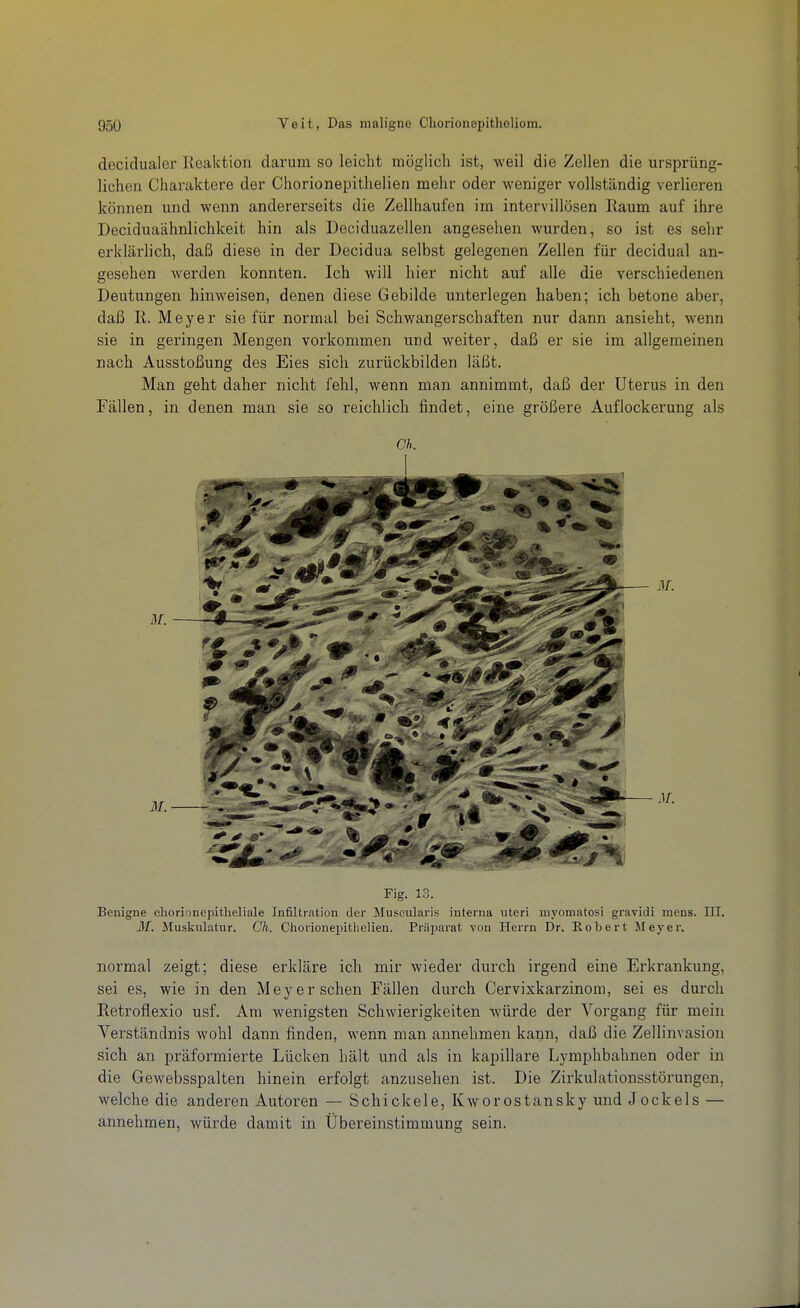 decidualer Reaktion darum so leicht raöglicli ist, weil die Zellen die ursprüng- lichen Charaktere der Chorionepithelien mehr oder weniger vollständig verlieren können und wenn andererseits die Zellhaufen im intervillösen Raum auf ihre Deciduaähnlichkeit hin als Deciduazellen angesehen wurden, so ist es sehr erklärlich, daß diese in der Decidua selbst gelegenen Zellen für decidual an- gesehen werden konnten. Ich will hier nicht auf alle die verschiedenen Deutungen hinweisen, denen diese Gebilde unterlegen haben; ich betone aber, daß R. Meyer sie für normal bei Schwangerschaften nur dann ansieht, wenn sie in geringen Mengen vorkommen und weiter, daß er sie im allgemeinen nach Ausstoßung des Eies sich zurückbilden läßt. Man geht daher nicht fehl, wenn man annimmt, daß der Uterus in den Fällen, in denen man sie so reichlich findet, eine größere Auflockerung als Ch. Fig. 13. Benigne cliorinnepitheliale Infiltration der Muscularis interna uteri myomatosi gravidi mens. III. 3f. Muskulatur. Ch. Chorionepithelien. Präparat von Herrn Dr. Robert Meyer. normal zeigt; diese erkläre ich mir wieder durch ii'gend eine Erkrankung, sei es, wie in den Meyer sehen Fällen durch Cervixkarzinom, sei es durch Retroflexio usf. Am wenigsten Schwierigkeiten würde der Vorgang für mein Verständnis wohl dann finden, wenn man annehmen kann, daß die Zellinvasion sich an präformierte Lücken hält und als in kapillare Lymphbahnen oder in die Gewebsspalten hinein erfolgt anzusehen ist. Die Zirkulationsstörungen, welche die anderen Autoren — Schickele, Kworostansky und Jockels — annehmen, würde damit in Übereinstimmung sein.