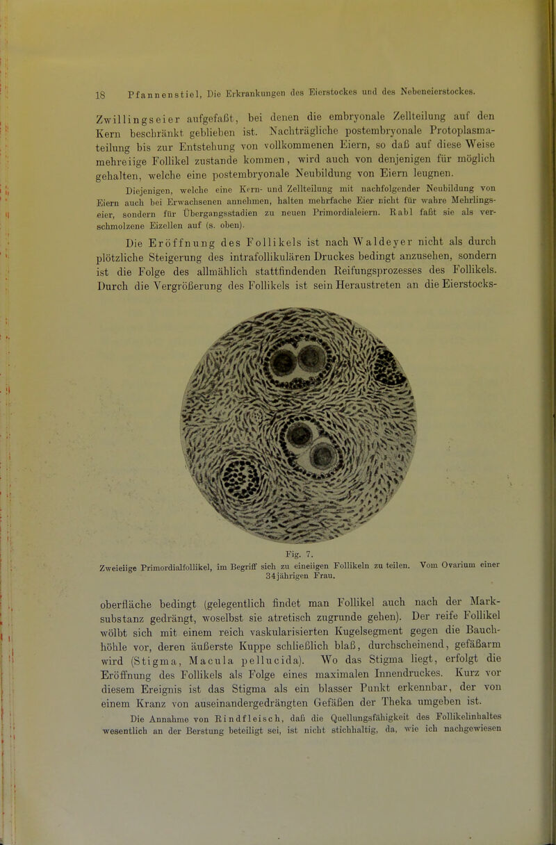 Zwillings ei er aufgefaßt, bei denen die embryonale Zellteilung auf den Kern beschränkt geblieben ist. Nachträgliche postembryonale Protoplasma- teilung bis zur Entstehung von vollkommenen Eiern, so daß auf diese Weise mehreiige Follikel zustande kommen, wird auch von denjenigen für möglich gehalten, welche eine postembryonale Neubildung von Eiern leugnen. Diejenigen, welche eine Kern- und Zellteilung mit nachfolgender Neubildung von Eiern auch bei Erwachsenen annehmen, halten mehrfache Eier nicht für wahre Mehrlings- eier, sondern für Übergangsstadien zu neuen Primordialeiem. Rabl faßt sie als ver- schmolzene Eizellen auf (s. oben). Die Eröffnung des Follikels ist nachWaldeyer nicht als durch plötzliche Steigerung des intrafollikulären Druckes bedingt anzusehen, sondern ist die Folge des allmählich stattfindenden Reifungsprozesses des Follikels. Durch die Vergrößerung des Follikels ist sein Heraustreten an die Eierstocks- Fig. 7. Zweieiige Primordialfollikel, im Begriff sich zu eineiigen Follikeln zu teilen. Vom Ovariuni einer 34jährigen Frau. Oberfläche bedingt (gelegentlich findet man Follikel auch nach der Mark- substanz gedrängt, woselbst sie atretisch zugrunde gehen). Der reife Follikel wölbt sich mit einem reich vaskularisierten Kugelsegment gegen die Bauch- höhle vor, deren äußerste Kuppe schließlich blaß, durchscheinend, gefäßarm wird (Stigma, Macula pellucida). Wo das Stigma liegt, erfolgt die Eröffnung des Follikels als Folge eines maximalen Innendruckes. Kurz vor diesem Ereignis ist das Stigma als ein blasser Punkt erkennbar, der von einem Kranz von auseinandergedrängten Gefäßen der Theka umgeben ist. Die Annahme von Rindfleisch, daß die Quellungsfiihigkeit des Follikelinhaltes wesentlich an der Berstung beteiligt sei, ist nicht stichhaltig, da, wie ich nachgewiesen