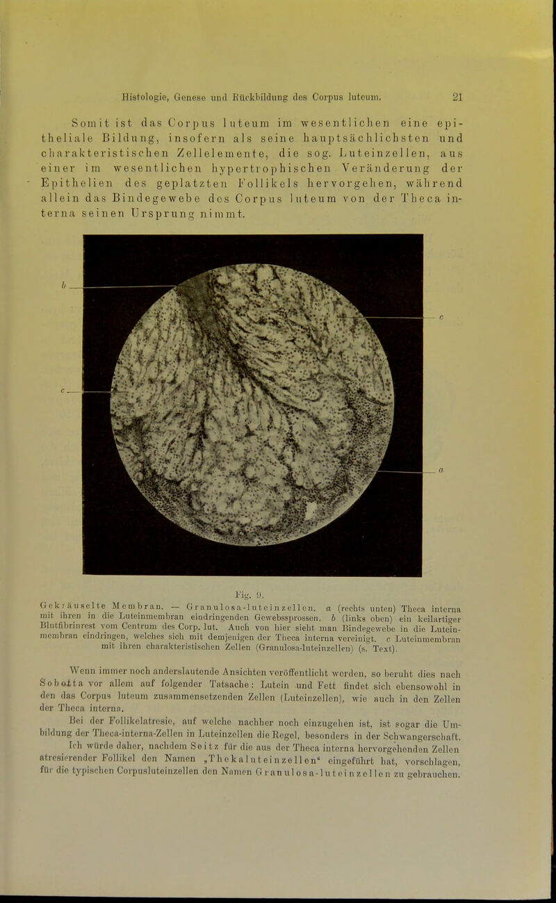 Somit ist das Corpus luteum im wesentlichen eine epi- theliale Bildung, insofern als seine hauptsächlichsten und charakteristischen Zellelemente, die sog. Luteinzellen, aus einer im wesentlichen hypertrophischen Veränderung der Epithelien des geplatzten Follikels hervorgehen, während allein das Bindegewebe dos Corpus luteum von der Theca in- terna seinen Ursprung nimmt. Fig. ü. Goki äiiselte Mcmbrau. — G ran u lo s a-1 u t e i n z el 1 cu. a (rechts uuten) Theca interna mit ihren in die Luteinmembran eindringenden Gewebssprossen. b {Ymks oben) ein keilartiger Bliitfibrinrost vom Centrum des Corp. lut. Auch von hier sieht man Bindege^Febe in die Lutein- membran eindringen, welches sich mit demjenigen der Tiieca interna vereinigt, c Luteinmembran mit ihren charakteristischen Zellen (Granulosa-luteinzellen) {a^ Text). Wenn immer noch anderslautende Ansichten vcröft'entlieht werden, so beruht dies nach Soboita vor allem auf folgender Tatsache: Lutein und Fett findet sich ebcnsoAvolil in den das Corpus luteum zusammensetzenden Zellen (Luteinzellen), wie auch in den Zellen der Theca interna. Bei der FoUikolatresie, auf welche nachher noch einzugehen ist, ist sogar die Um- bildung der Theca-interna-Zellen in Luteinzellen die Regel, besonders in der Schwangerschaft. Ich würde daher, nachdem Seitz für die ans der Theca interna hervorgehenden Zellen atresierendcr Follikel den Namen Iicka 1 uteinze 11 en eingefülu-t hat, vorschlagen, für die typischen Corpusluteinzellen den Nnmen G r an ul os a-lu tci n zol 1 o n zu gebrauchen!