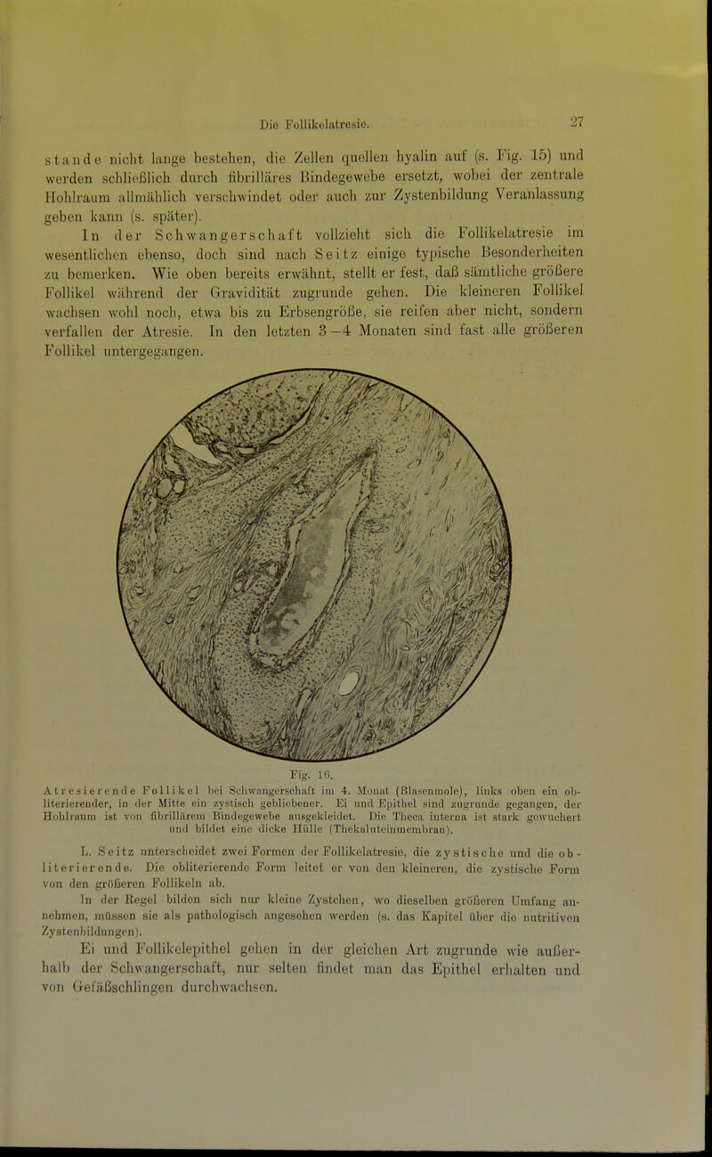 Stande nicht lange bestehen, die Zellen quellen hyalin auf (s. Fig. 15) und werden schließlich durch fibrilläres Bindegewebe ersetzt, wobei der zentrale Hohlraum allmählich verschwindet oder auch zur Zystenbildung Veranlassung geben kann (s. später). In der Schwangerschaft vollzieht sich die Follikelatresie im wesentlichen ebenso, doch sind nach Seitz einige typische Besonderheiten zu bemerken. Wie oben bereits erwähnt, stellt er fest, daß sämtliche größere Follikel während der Gravidität zugrunde gehen. Die kleineren Follikel wachsen wohl noch, etwa bis zu Erbsengröße, sie reifen aber nicht, sondern verfallen der Atresie. In den letzten 3-4 Monaten sind fast alle größeren Follikel untergegangen. Fig. 16. A t r e s i e r e n (1 e Follikel bei Schwangerschaft im 4. Monat (ßlasenmole), links oben ein ob- literierender, in der Mitte ein zystisch gebliebcDcr. Ei und Epithel sind zugrunde gegangen, der Hohlraum ist von fibrillärem Bindegewebe ausgekleidet. Die Theca iuterna ist stark gewuchert und bildet eine dicke Hülle (Thekaluteinmembrau). L. Seitz unterscheidet zwei Formen der Follikelatresie, die zystische und die ob- literierende. Die obliterierende Forin leitet er von den kleineren, die zystisclie Form von den größeren Follikeln ab. In der Regel bilden sich nur kleine Zyatchen, wo dieselben größeren Umfang an- nehmen, müssen sie als pathologisch angesehen werden (s. das Kapitel über die nutritiven Zystenbildungen). Ei und Follikelepithel gehen in der gleichen Art zugrunde wie außer- halb der Schwangerschaft, nur selten findet man das Epithel erhalten und von Gefäßschlingen durchwachsen.