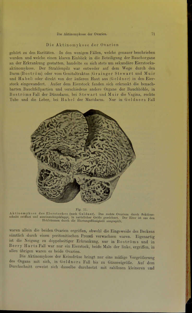 Die Aktinomykose dei' Ovarien gehört zu den Earitäten. In den wenigen Fällen, welche genauer beschrieben wurden und welche einen klaren Einblick in die Beteiligung der Bauchorgane an der Erkrankung gestatten, handelte es sich stets um sekundäre Eierstocks- aktinomykose. Der Strahlenpilz war entweder auf dem Wege durch den Darm (Boström) oder vom Genitaltraktus (Grainger Stewart und Muir und Habel) oder direkt von der äußeren Haut aus (G e 1 d n e r) in den Eier- stock eingewandert. Außer dem Eierstock fanden sich erkrankt die benach- barten Bauchfellpartien und verschiedene andere Organe der Bauchhöhle, in BoströmsFall der Dünndarm, bei Stewart und Muir die Vagina, rechte Tube und die Leber, bei Habel der Mastdarm. Nur in Geldners Fall Fig. 31. Aktinomykose des Eierstoekes (nach Geldner). Das rechte Ovarium durch Sektions- schnitt eröffnet und auseinandergeklappt,, in natürlicher Größe gezeichnet. Der Eiter ist aus den Hohlräumen durch die Härtungsflüssigkeit .ausgespült. waren allein die beiden Ovarien ergriffen, obwohl die Eingeweide des Beckens sämtlich durch einen peritonitischen Prozeß verwachsen waren. Eigenartig ist die Neigung zu doppelseitiger Erkrankung, nur in Boströms und in Berry Harts Fall war nur ein Eierstock, beide Male der linke, ergriffen, in allen übrigen waren es beide Ovarien. Die Aktinomykose der Keimdrüse bringt nur eine mäßige Vergrößerung des Organs mit sich, in Geldners Fall bis zu Gänseeigröße. Auf dem Durchschnitt erweist sich dasselbe durchsetzt mit zahllosen kleineren und