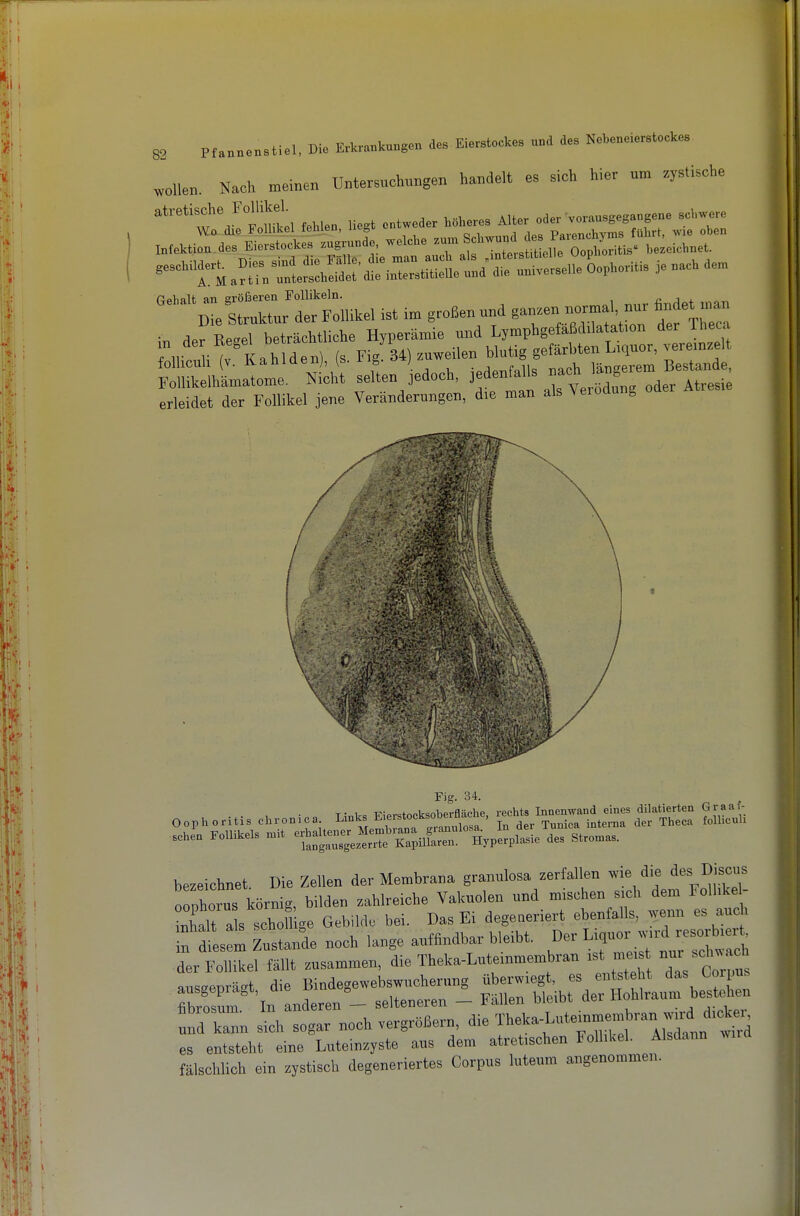 wollen. Nach meinen Untersuchungen handelt es sich hier um zystische ^'wriCe, «en. liegt entweder .».eres ^Sr^tZ Infektion.des -Erersteckes ™gr„nde, welche ^^Zl^'^^^^'l^^^^ '^TeCLTtmUel ist im großen und gan.en normal, nur findet man in der Cel beträchtliche Hyperamie und Lymphgefäßdilatation der Theca ,n der Rege beua Mutig gefärbten Liquor, veremzelt folliculi (v. Kahldenj, (s. iig. ot,^ „j„„f„ii, „«ch längerem Bestände, Follikelhämatome. Nicht selten jedoch. '^^f^^^^Z ^^t,^ „der Atresie erleidet der Follikel jene Veränderungen, die man als veroa g I Fig. 34. . , • T^nlr« -Riprstocksoberfläche, rechts Innenwand eines dilatierten Graaf- ?r Ä-^n^J^Ä ^^^^^^^^^^^ - - — bezeichnet. Die Zellen der Membrana granulosa zerfallen me die des Discos ooZrus körnig, bilden zahlreiche Vakuolen und mischen sich dem Folhkel- Lhalt a s schon ge Gebilde bei. Das Ei degeneriert ebenfalls, wenn es auch f ts m ztande noch lange auffindbar bleibt. Der ^i^-r ..rd^esorbi^ der Follikel fällt zusammen, die Theka-Luteinmembran ist me. ^'J'^^^^ ausaenräst die Bindegewebswucherung überwiegt, es entsteht das Corpus fib 'in anderen - selteneren - Fällen «eibt der Hohlraum bestehen und kann sich sogar noch vergrößern, ^ie Theka-Lutemmem ran w^^^^^^ es entsteht eine Lutein^yste aus dem atretischen Follikel. Alsdann wua fälschlich ein zystisch degeneriertes Corpus luteum angenommen. 1