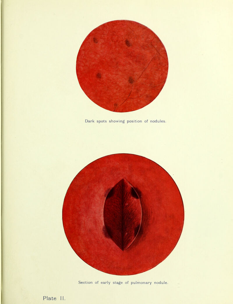 Dark spots showing position of nodules. Section of early stage of pulmonary nodule..