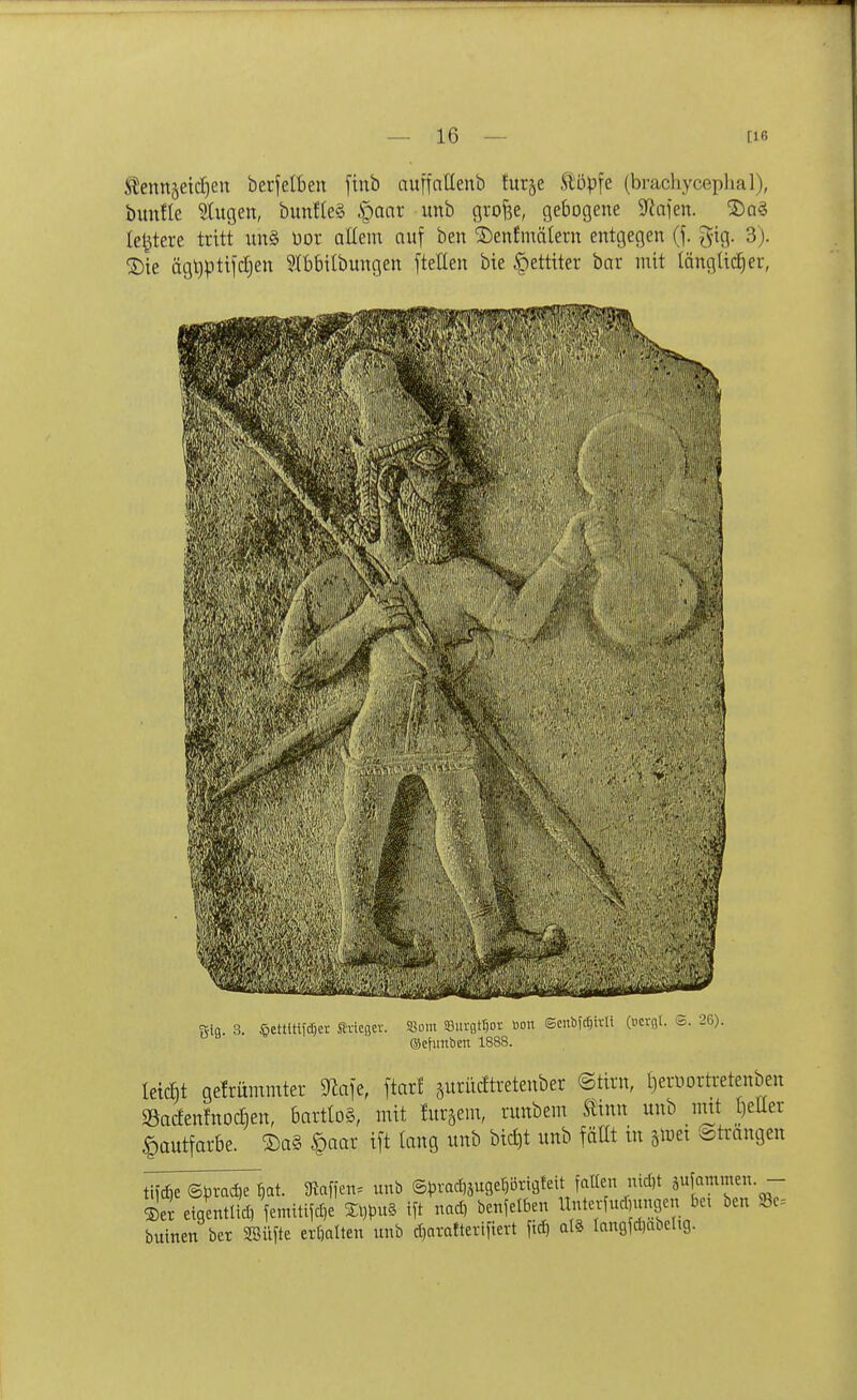 ^enn^eicljen berfelbeu [tub aufiattenb turje 9:'6p\t (brachyceplial), bimlle klugen, bimfle§ §anr unb groj^e, gebogene 5Rnien. ®a§ leitete tritt un§ üor allem nuf ben ^enJmäteru entgegen (j. gig. 3). 2)te ägl)pttfd)en Stbbilbungen ftetlen bie |)ettiter bar mit (änglii^er, «ifl. 3. 6ettltt(cr)er SviCBer. SBoin SBurgttjor Mit ©citbidjivU (i'cvnU S. 26). ©cfuitbeit 1888. Iet(f)t gefrümmter ^^iafe, ftarf äuriidtretenber ©tirn, t)eruortretenben Sadenfnoc&en, bartlog, mit lurgem, runbem Stinn unb mit t)eUer Hautfarbe. Sag |)aar ift lang unb bici)t unb fäHt in jltjet ^ti-angen tif^e Sptadie ^at. SRaffen. unb (5^3vacl)juger)örtgteit faüen nid)t ®et eiaentlid, femitiid)e Sl)pu§ ift nad, benfelben llntei1ud,unGen bei ben Sc- buinen ber SBÜfte erhalten unb d)arafterifiert ftd) alä langfdiabeltg.