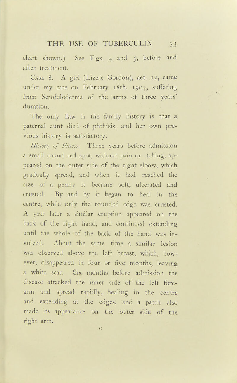 chart shown.) See Figs. 4 and 5, before and after treatment. Case 8. A girl (Lizzie Gordon), aet. 12, came under my care on February i8th, 1904, suffering from Scrofuloderma of the arms of three years' duration. The only flaw in the family history is that a paternal aunt died of phthisis, and her own pre- vious history is satisfactory. History of Illness. Three years before admission a small round red spot, without pain or itching, ap- peared on the outer side of the right elbow, which gradually spread, and when it had reached the size of a penny it became soft, ulcerated and crusted. By and by it began to heal in the centre, while only the rounded edge was crusted. A year later a similar eruption appeared on the back of the right hand, and continued extending until the whole of the back of the hand was in- volved. About the same time a similar lesion was observed above the left breast, which, how- ever, disappeared in four or five months, leaving a white scar. Six months before admission the disease attacked the inner side of the left fore- arm and spread rapidly, healing in the centre and extending at the edges, and a patch also made its appearance on the outer side of the right arm. c