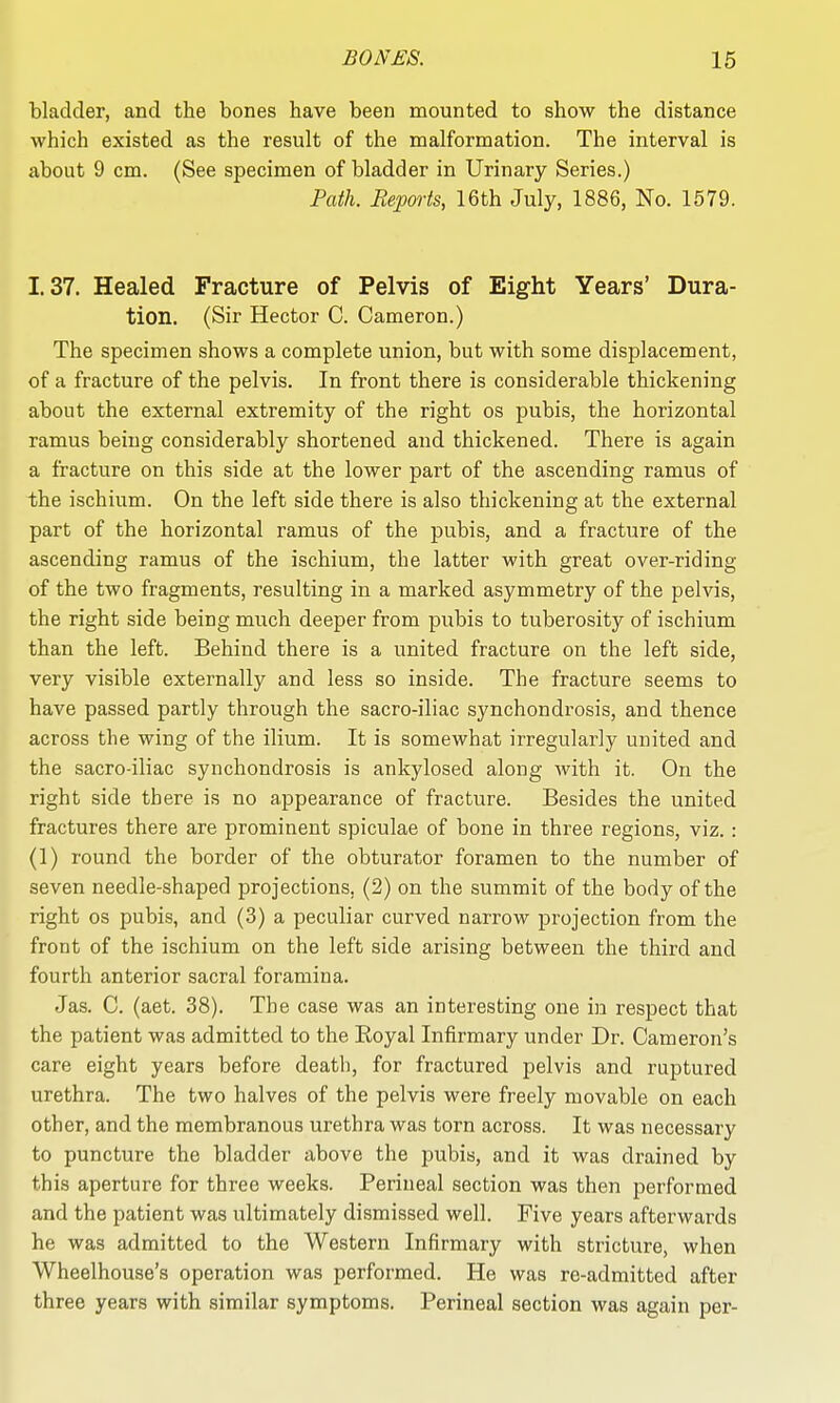 bladder, and the bones have been mounted to show the distance which existed as the result of the malformation. The interval is about 9 cm. (See specimen of bladder in Urinary Series.) Path. Reports, 16th July, 1886, No. 1579. 1.37. Healed Fracture of Pelvis of Eight Years' Dura- tion. (Sir Hector C. Cameron.) The specimen shows a complete union, but with some displacement, of a fracture of the pelvis. In front there is considerable thickening about the external extremity of the right os pubis, the horizontal ramus being considerably shortened and thickened. There is again a fracture on this side at the lower part of the ascending ramus of the ischium. On the left side there is also thickening at the external part of the horizontal ramus of the pubis, and a fracture of the ascending ramus of the ischium, the latter with great over-riding of the two fragments, resulting in a marked asymmetry of the pelvis, the right side being much deeper from pubis to tuberosity of ischium than the left. Behind there is a united fracture on the left side, very visible externally and less so inside. The fracture seems to have passed partly through the sacro-iliac synchondrosis, and thence across the wing of the ilium. It is somewhat irregularly united and the sacro-iliac synchondrosis is ankylosed along with it. On the right side there is no appearance of fracture. Besides the united fractures there are prominent spiculae of bone in three regions, viz. : (1) round the border of the obturator foramen to the number of seven needle-shaped projections, (2) on the summit of the body of the right OS pubis, and (3) a peculiar curved narrow projection from the front of the ischium on the left side arising between the third and fourth anterior sacral foramina. Jas. C. (aet. 38). The case was an interesting one in respect that the patient was admitted to the Eoyal Infirmary under Dr. Cameron's care eight years before death, for fractured pelvis and ruptured urethra. The two halves of the pelvis were freely movable on each other, and the membranous urethra was torn across. It was necessary to puncture the bladder above the pubis, and it was drained by this aperture for three weeks. Perineal section was then performed and the patient was ultimately dismissed well. Five years afterwards he was admitted to the Western Infirmary with stricture, when Wheelhouse's operation was performed. He was re-admitted after three years with similar symptoms. Perineal section was again per-