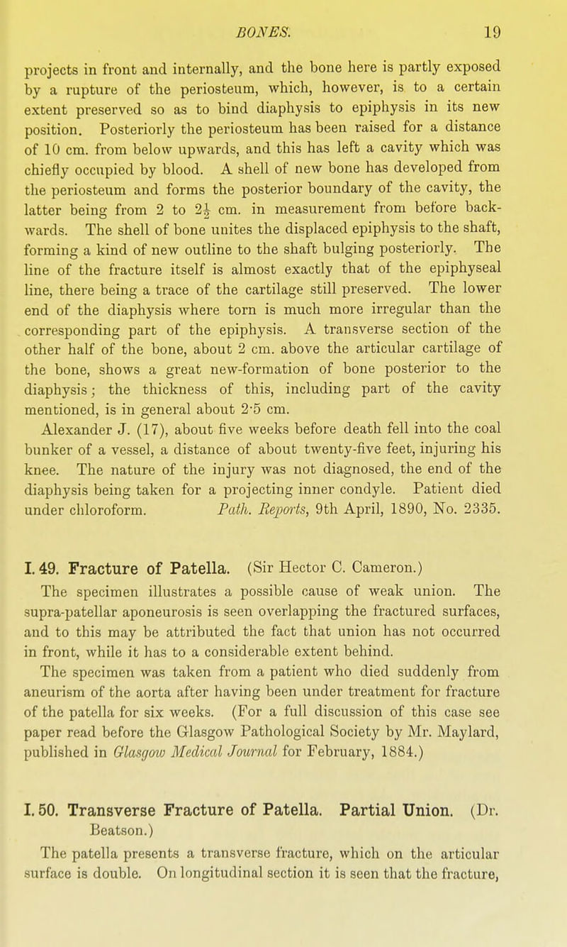 projects in front and internally, and the bone here is partly exposed by a rupture of the periosteum, which, however, is to a certain extent preserved so as to bind diaphysis to epiphysis in its new position. Posteriorly the periosteum has been raised for a distance of 10 cm. from below upwards, and this has left a cavity which was chiefly occupied by blood. A shell of new bone has developed from the periosteum and forms the posterior boundary of the cavity, the latter being from 2 to 2|- cm. in measurement from before back- wards. The shell of bone unites the displaced epiphysis to the shaft, forming a kind of new outline to the shaft bulging posteriorly. The line of the fracture itself is almost exactly that of the epiphyseal line, there being a trace of the cartilage still preserved. The lower end of the diaphysis where torn is much more irregular than the corresponding part of the epiphysis. A transverse section of the other half of the bone, about 2 cm. above the articular cartilage of the bone, shows a great new-forraation of bone posterior to the diaphysis; the thickness of this, including part of the cavity mentioned, is in general about 2'5 cm. Alexander J. (17), about five weeks before death fell into the coal bunker of a vessel, a distance of about twenty-five feet, injuring his knee. The nature of the injury was not diagnosed, the end of the diaphysis being taken for a projecting inner condyle. Patient died under chloroform. Path. Repmis, 9th April, 1890, No. 2335. 1.49. Fracture of Patella. (Sir Hector C. Cameron.) The specimen illustrates a possible cause of weak union. The supra-patellar aponeurosis is seen overlapping the fractured surfaces, and to this may be attributed the fact that union has not occurred in front, while it has to a considerable extent behind. The specimen was taken from a patient who died suddenly from aneurism of the aorta after having been under treatment for fracture of the patella for six weeks. (For a full discussion of this case see paper read before the Glasgow Pathological Society by Mr. Maylard, published in Glasgmo Medical Journal for February, 1884.) 1.50. Transverse Fracture of Patella. Partial Union. (Dr. Beatson.) The patella presents a transverse fracture, which on the articular surface is double. On longitudinal section it is seen that the fracture,