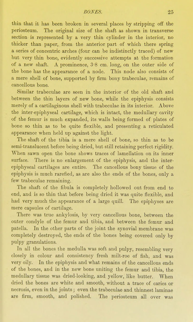 thin that it has been broken in several places by stripping off the periosteum. The original size of the shaft as shown in transverse section is represented by a very thin cylinder in the interior, no thicker than paper, from the anterior part of which there spring a series of concentric arches (four can be indistinctly traced) of new but very thin bone, evidently successive attempts at the formation of a new shaft. A prominence, 38 cm. long, on the outer side of the bone has the appearance of a node. This node also consists of a mere shell of bone, supported by firm bony trabeculae, remains of cancellous bone. Similar trabeculae are seen in the interior of the old shaft and between the thin layers of new bone, while the epiphysis consists merely of a cartilaginous shell with trabeculae in its interior. Above the inter-epiphyseal cartilage, which is intact, the medullary cavity of the femur is much expanded, its walls being formed of plates of bone so thin as to be quite flexible, and presenting a reticulated appearance when held up against the light. The shaft of the tibia is a mere shell of bone, so thin as to be semi-translucent before being dried, but still retaining perfect rigidity. When sawn open the bone shows traces of lamellation on its inner surface. There is no enlargement of the epiphysis, and the inter- epiphyseal cartilages are entire. The cancellous bony tissue of the epiphysis is much rarefied, as are also the ends of the bones, only a few trabeculae remaining. The shaft of the fibula is completely hollowed out from end to end, and is so thin that before being dried it was quite flexible, and had very much the appearance of a large quill. The epiphyses are mere capsules of cartilage. There was true ankylosis, by very cancellous bone, between the outer condyle of the femur and tibia, and between the femur and patella. In the other parts of the joint the synovial membrane was completely destroyed, the ends of the bones being covered only by pulpy granulations. In all the bones the medulla was soft and pulpy, resembling very closely in colour and consistency fresh milt-roe of fish, and was very oily. In the epiphysis and what remains of the cancellous ends of the bones, and in the new bone uniting the femur and tibia, the medullary tissue was dried-looking, and yellow, like butter. When dried the bones are white and smooth, without a trace of caries or necrosis, even in the joints; even the trabeculae and thinnest laminae are firm, smooth, and polished. The periosteum all over was