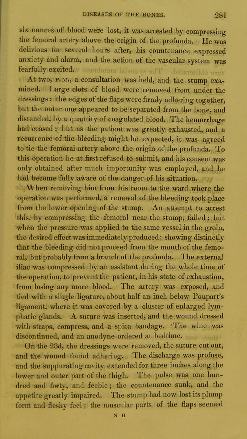 six ounces of blood were lost, it was arrested by compressing the femoral artery above the origin of the profunda. He was delirious for several hours after, his countenance expressed anxiety and alarm, and the action of the vascular system was fearfully excited. At two, P.M., a consultation was held, and the stump exa- mined. Large clots of blood were removed from under the dressings; the edges of the flaps were firmly adhering together, but the outer one appeared to be separated from the bone, and distended, by a quantity of coagulated blood. The hemorrhage had ceased; but as the patient was greatly exhausted, and a recurrence of the bleeding might be expected, it was agreed to tie the femoral artery above the origin of the profunda. To this operation he at first refused to submit, and his consent was only obtained after much importunity was employed, and , he had become fully aware of the danger of his situation. ■ When removing him from his room to the ward where the operation was performed, a renewal of the bleeding took place from the lower opening of the stump. An attempt to ai'rest this, by compressing the femoral near the stump, failed; but when the pressure was applied to the same vessel in the groin, the desired effect was immediately produced: showing distinctly that the bleeding did not proceed from the mouth of the femo- ral, but probably from a branch of the profunda. The external iliac was compressed by an assistant during the whole time of the operation, to prevent the patient, in his state of exhaustion, from losing any more blood. The artery was exposed, and tied with a single ligature, about half an inch below Poupart's ligament, where it was covered by a cluster of enlarged lym- phatic glands. A suture was inserted, and the wound dressed with straps, compress, and a spica bandage. 'The wine was discontinued, and an anodyne ordered at bedtime. On the 23d, the dressings were removed, the suture cut out, and the wound found adhering. The discharge was profuse, and the suppurating cavity extended for three inches along the lower and outer part of the thigh. The pulse was one hun- dred and forty, and feeble; the countenance sunk, and the appetite greatly impaired. The stump had now lost its plump form and fleshy feel; the muscular parts of the flaps seemed N n