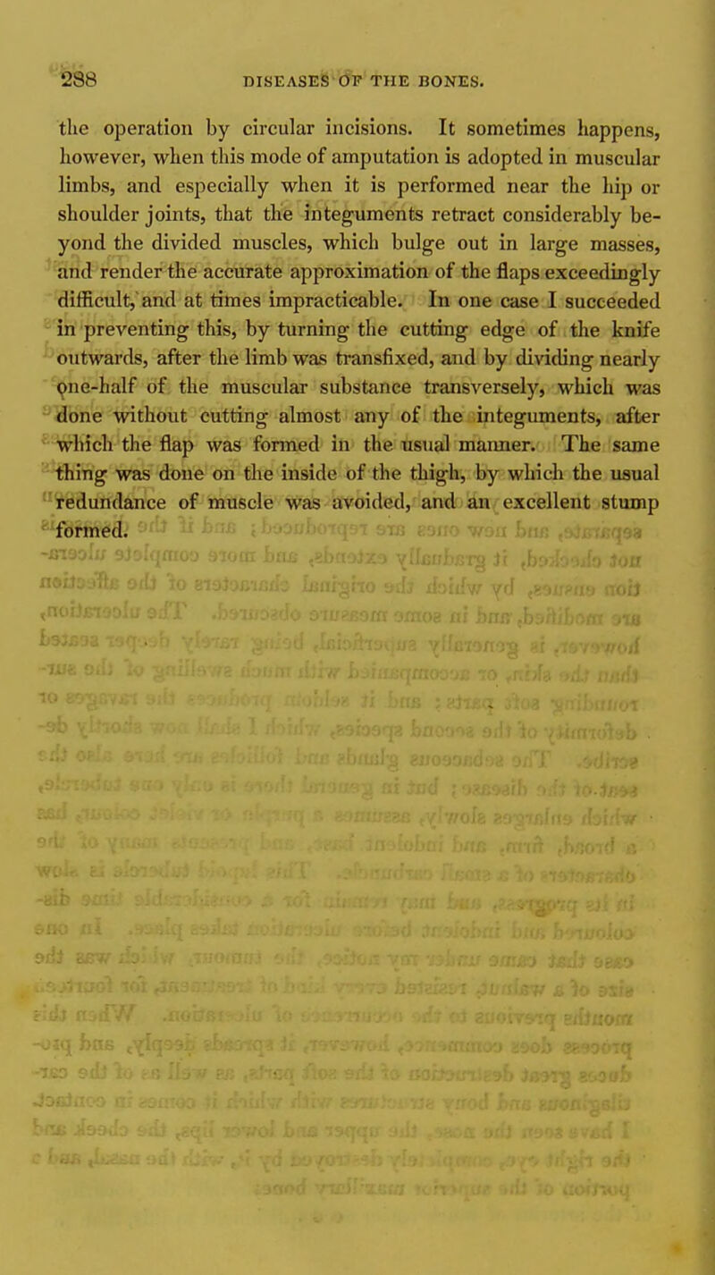 the operation by circular incisions. It sometimes happens, however, when this mode of amputation is adopted in muscular limbs, and especially when it is performed near the hip or shoulder joints, that the integuments retract considerably be- yond the divided muscles, which bulge out in large masses, ^'Srid render the accurate approximation of the flaps exceedingly difficult,and at times impracticable. In one case I succeeded  in preventing this, by turning the cutting edge of the knife ■ outwards, after the limb was transfixed, and by dividing nearly ^ne-half of the muscular substance transversely, which was ^Hbhe without cutting almost any of the integuments, after '^Kich the flap was formed in the usual maimer. The same ' thing was done on the inside of the thigh, by which the usual 'redundance of muscle was avoided, and;jaa{excellent stump ■formed. ' 'M- ;'; ih-joui- ■ ■!:; .••■■!■■•' •won hi! ■ •aiaolx; 9J0; .ai Jbnx,- t^ Ir t' fw yd Of J