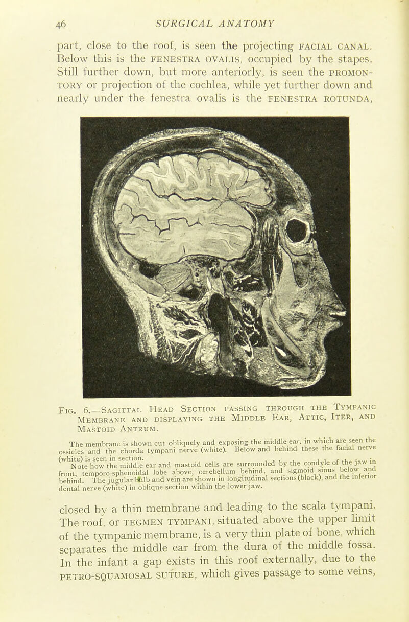 part, close to the roof, is seen the projecting facial canal. Below this is the fenestra ovalis, occupied by the stapes. Still further down, but more anteriorly, is seen the promon- tory or projection of the cochlea, while yet further down and nearly under the fenestra ovalis is the fenestra rotunda, Fig. 6.—Sagittal Head Section passing through the Tympanic 'membrane and displaying the Middle Ear, Attic, Iter, and Mastoid Antrum. The membrane is shown cut obliquely and exposing the middle ear, in which are seen the irle^ and the chorda tvmpani nerve (white). Below and behmd these the facial nerve (white), (white) is seen in section. ^ ^^^^^ surrounded by the condyle of the jaw in 1 ferior ossicles and the chorda tympan hite) is seen in section. Note how the middle ear ani front, temporo-sphenoidal lobe above, cerebellum behind, and sigmoid sinus belo« behind. The jugular Htilb and vein are shown in longitiidmal sections (black), and the in dental nerve (white) in oblique section within the lower jaw. closed by a thin membrane and leading to the scala tympani. The roof, or tegmen tympani, situated above the upper limit of the tympanic membrane, is a very thin plate of bone, which separates the middle ear from the dura of the middle fossa. In the infant a gap exists in this roof externally, due to the petro-squamosal suture, which gives passage to some veins,