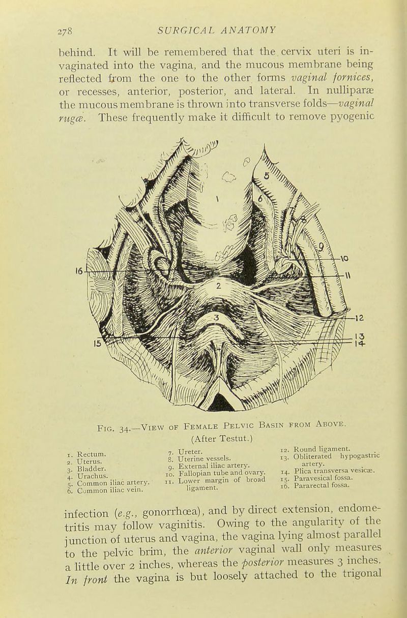 liehind. It will be remembered that the cervix uteri is in- vaginated into the vagina, and the mucous membrane being reflected from the one to the other fonns vaginal fornices, or recesses, anterior, posterior, and lateral. In nulliparae the mucous membrane is thrown into transverse folds—vagina! rugcB. These frequently make it difficult to remove pyogenic Fig. 34.—View of Female Pelvic Basin from Above. (After Testut.) Rectum. Uterus. Bladder. Urachus. Common iliac artery. 6. Common iliac vein. 7. Ureter. 8. Uterine vessels. g. External iliac artery. 10. Fallopian tube and ovary. 11. Lower margin of broad ligament. 12. Round lieament. 13. Obliterated hypogastric artery. 14. Plica transversa vesicse. 15. Paravesical fossa. 16. Pararectal fossa. infection [e.g., gonorrhoea), and by direct extension, endome- tritis may follow vaginitis. Owing to the angularity of the junction of uterus and vagina, the vagina lying almost parallel to the pelvic brim, the anterior vaginal wall only measures a little over 2 inches, whereas the posterior measures 3 inches. In front the vagina is but loosely attached to the trigonal