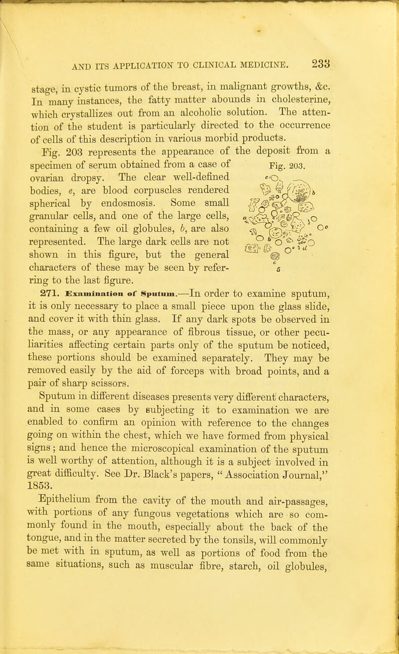 stage, in cystic tumors of the breast, in malignant growths, &c. In many instances, the fatty matter abounds in cholesterine, which crystallizes out from an alcoholic solution. The atten- tion of the student is particiilarly directed to the occurrence of cells of this description in various morbid products. Fig. 203 represents the appearance of the deposit from a specimen of serum obtained from a case of ovarian dropsy. The clear well-defined bodies, e, are blood corpuscles rendered '\°)^.,^'° spherical by endosmosis. Some small {Jf'f^^^ granular cells, and one of the large cells, ^^^^i^.^FT^o containing a few oil globules, b, are also 'a}^^:^<^. „ represented. The large dark cells are not o '^ shown in this figure, but the general ® characters of these may be seen by refer- ring to the last figure. 271. Examination of Sputum.—In Order to examine sputum, it ia only necessary to place a small piece upon the glass sUde, and cover it with thin glass. If any dark spots be observed in the mass, or any appearance of fibrous tissue, or other pecu- liarities afiecting certain parts only of the sputum be noticed, these portions should be examined separately. They may be removed easily by the aid of forceps with broad points, and a pair of sharp scissors. Sputum in difierent diseases presents very difierent characters, and in some cases by subjecting it to examination we are enabled to confirm an opinion vsdth reference to the changes going on within the chest, which we have formed from physical signs; and hence the microscopical examination of the sputum is well worthy of attention, although it is a subject involved in great difficulty. See Dr. Black's papers, Association Journal, 1853. Epithelium from the cavity of the mouth and air-passages, with portions of any fungous vegetations which are so com- monly found in the mouth, especially about the back of the tongue, and in the matter secreted by the tonsils, will commonly be met with in sputum, as well as portions of food from the same situations, such as muscular fibre, starch, oil globiiles,