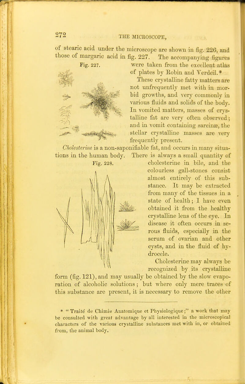 of stearic acid under the microscope are shown in fig. 226, and those of margaric acid in fig. 227. The accompanying figures Fig. 227. were taken from the excellent atlas of plates by Eobin and Verdeil. * These crystalline fatty matters are not unfrequently met with in mor- bid growtlis, and very commonly in various fluids and solids of the body. In vomited matters, masses of crys- talline fat are very often observed; and in vomit containing sarcinse, the stellar crystalline masses are very frequently present. Cholesterine is a non-saponifiable fat, and occurs in many situa- tions in the human body. There is always a small quantity of cholesterine in bUe, and the colourless gall-stones consist almost entirely of this sub- stance. It may be extracted from many of the tissues in a state of health; I have even obtained it from the healthy crystaUine lens of the eye. In disease it often occurs in se- rous fluids, especially in the serum of ovarian and other cysts, and in the fluid of hy- drocele. Cholesterine may always be recognized by its crj'stalline form (fig. 121), and may usually be obtained by the slow evapo- ration of alcoholic solutions ; but where only mere traces of this substance are present, it is necessary to remove the other *  Traite de Chimie Anatomique et Physiologique; a work that may be consulted with great advautage by all interested iu the microscopical characters of the various crystaUine substances met with in, or obtained from, the animal body.