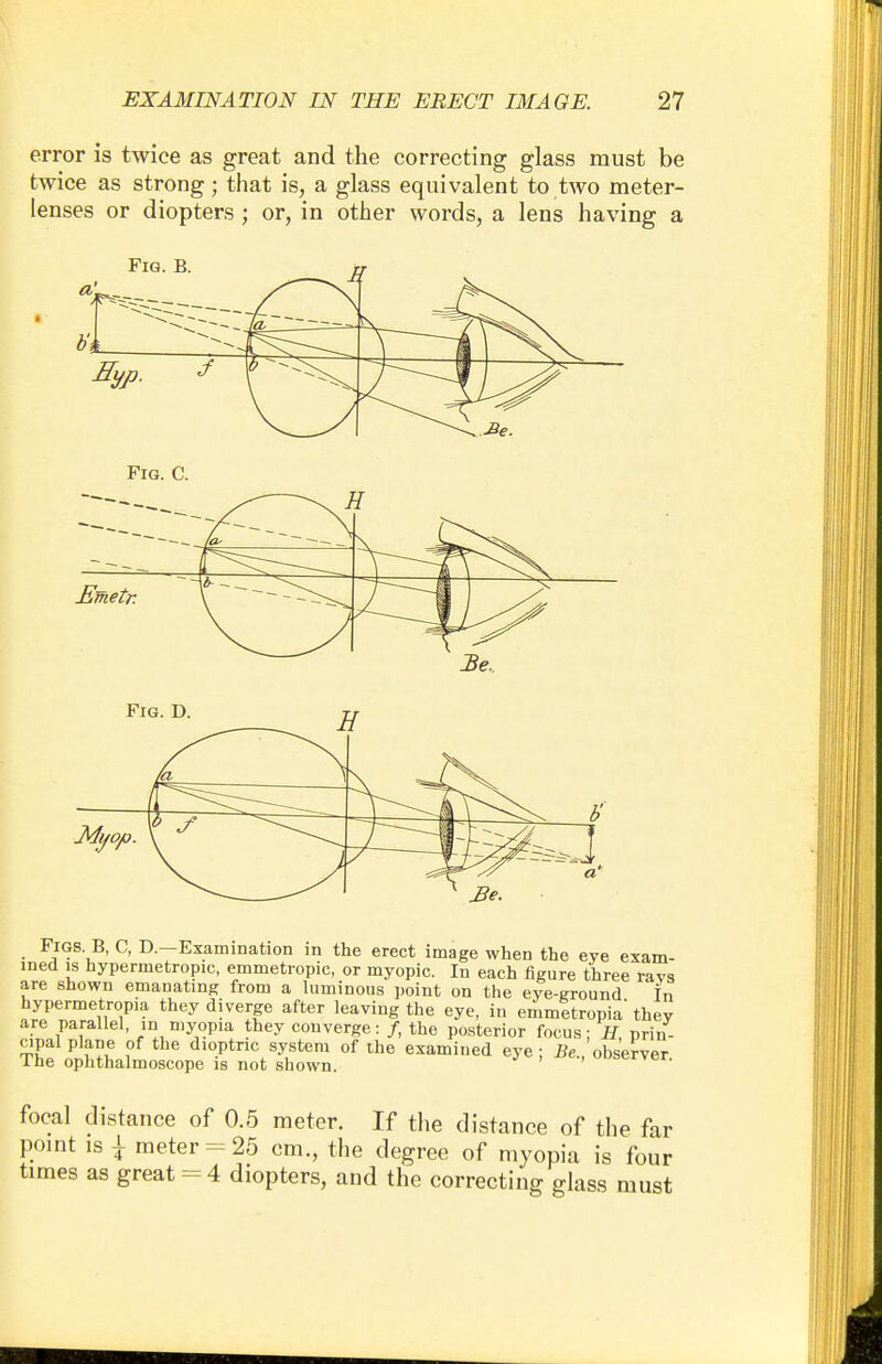 error is twice as great and the correcting glass must be twice as strong; that is, a glass equivalent to two meter- lenses or diopters ; or, in other words, a lens having a Fig. B. b'i , I f^VC.- \ Fig. C. Be. Figs. B, C, D.—Examination in the erect image when the eye exam- ined is hypermetropic, emmetropic, or myopic. In each figure three ravs are shown emanating from a luminous point on the eye-ground In hypermetropia they diverge after leaving the eye, in emmetropia' they are parallel, in myopia they converge: /, the posterior focus; H prin- cipal plane of the dioptric system of the examined eye; ^./observer Ihe ophthalmoscope is not shown. focal distance of 0.5 meter. If the distance of the far point is \ meter = 25 cm., the degree of myopia is four times as great = 4 diopters, and the correcting glass must