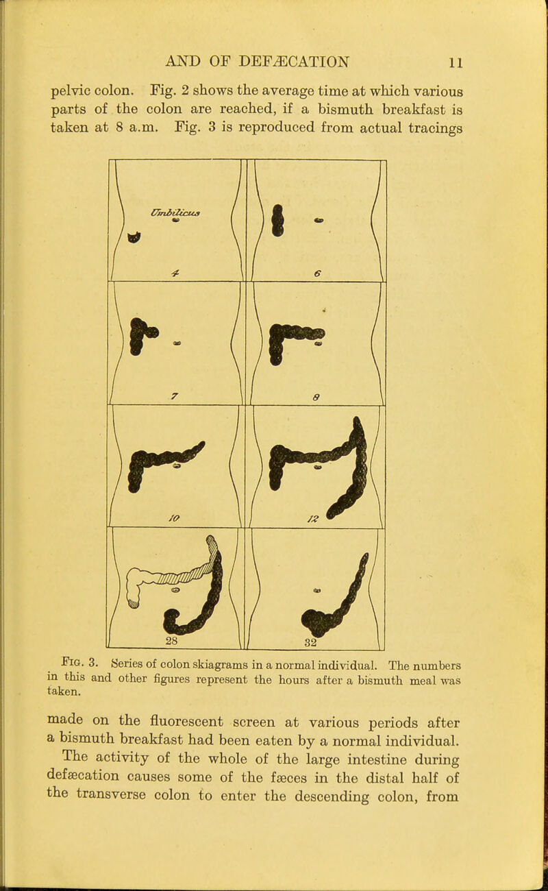 pelvic colon. Fig. 2 shows the average time at which various parts of the colon are reached, if a bismuth breakfast is taken at 8 a.m. Fig. 3 is reproduced from actual tracings • ' \ r • Fig. 3. Series of colon skiagrams in a normal individual. The numbers in this and other figures represent the hours after a bismuth meal was taken. made on the fluorescent screen at various periods after a bismuth breakfast had been eaten by a normal individual. The activity of the whole of the large intestine during defsecation causes some of the faeces in the distal half of the transverse colon to enter the descending colon, from