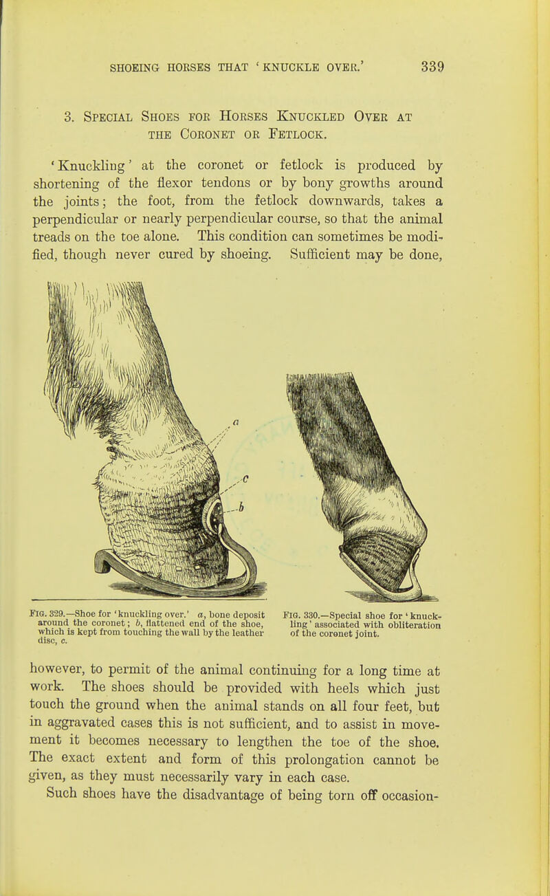 3. Special Shoes for Horses Knuckled Over at the Coronet or Fetlock. ' Knuckling' at the coronet or fetlock is produced by- shortening of the flexor tendons or by bony growths around the joints; the foot, from the fetlock downwards, takes a perpendicular or nearly perpendicular course, so that the animal treads on the toe alone. This condition can sometimes be modi- fied, though never cured by shoeing. Sufficient may be done, Fig. 329.—Shoe for 'knuckling over.' a, bone deposit FIG. 330.—Special shoe for ' knuck- around the coronet; 6, flattened end of the shoe, ling' associated with obliteration which is kept from touching the wall by the leather of the coronet joint, disc, c. however, to permit of the animal continuing for a long time at work. The shoes should be provided with heels which just touch the ground when the animal stands on all four feet, but in aggravated cases this is not sufficient, and to assist in move- ment it becomes necessary to lengthen the toe of the shoe. The exact extent and form of this prolongation cannot be given, as they must necessarily vary in each case. Such shoes have the disadvantage of being torn off occasion-