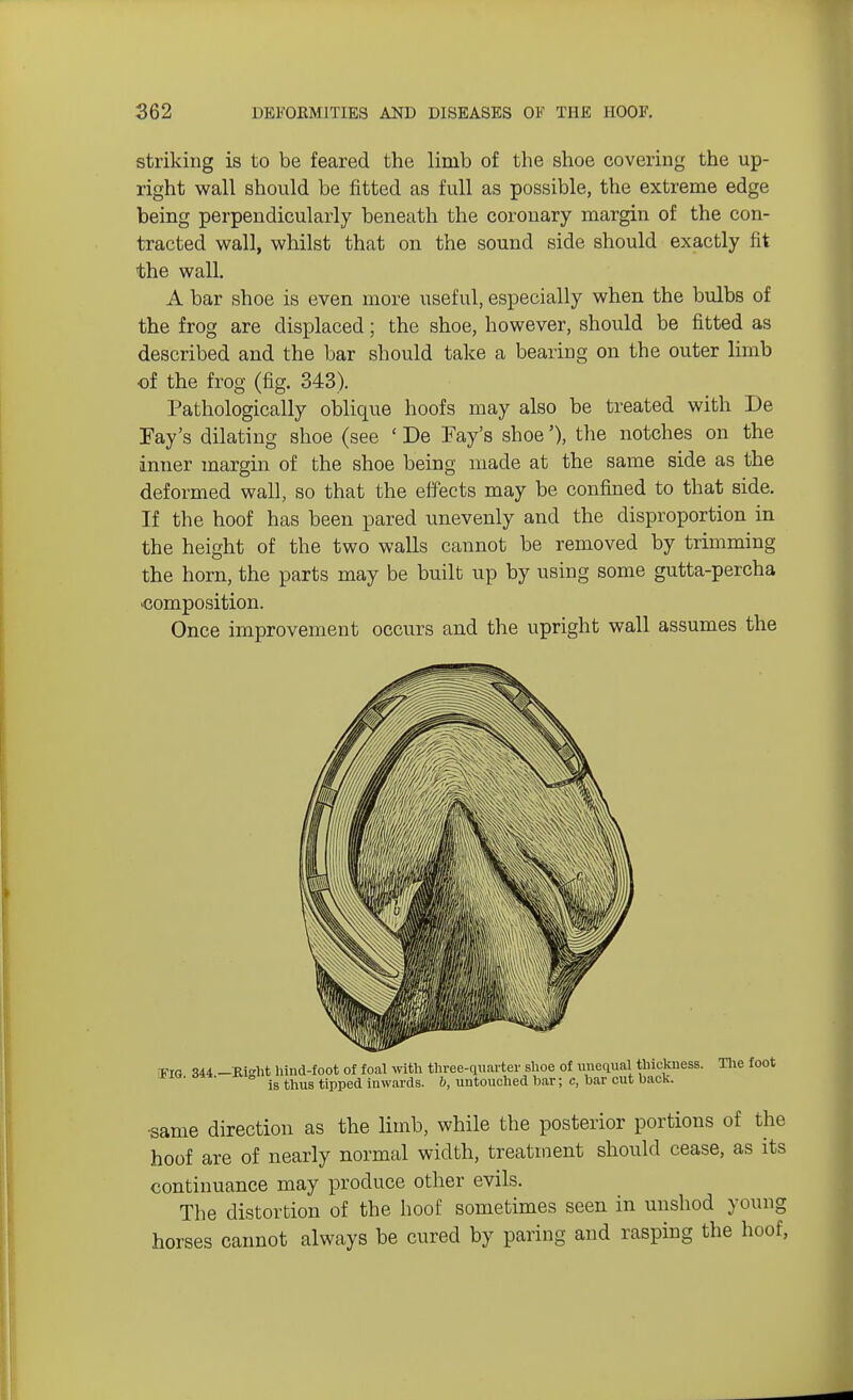 striking is to be feared the limb of the shoe covering the up- right wall should be fitted as full as possible, the extreme edge being perpendicularly beneath the coronary margin of the con- tracted wall, whilst that on the sound side should exactly fit the wall. A bar shoe is even more useful, especially when the bulbs of the frog are displaced; the shoe, however, should be fitted as described and the bar should take a bearing on the outer limb of the frog (fig. 343). Pathologically oblique hoofs may also be treated with De Fay's dilating shoe (see ' De Fay's shoe'), the notches on the inner margin of the shoe being made at the same side as the deformed wall, so that the effects may be confined to that side. If the hoof has been pared unevenly and the disproportion in the height of the two walls cannot be removed by trimming the horn, the parts may be built up by using some gutta-percha ^composition. Once improvement occurs and the upright wall assumes the Via 344 -Bight hind-foot of foal with three-quarter shoe of unequal thickness. The foot is thus tipped inwards. 6, untouched bar; c, bar cut back. •same direction as the limb, while the posterior portions of the hoof are of nearly normal width, treatment should cease, as its continuance may produce other evils. The distortion of the hoof sometimes seen in unshod young horses cannot always be cured by paring and rasping the hoof,