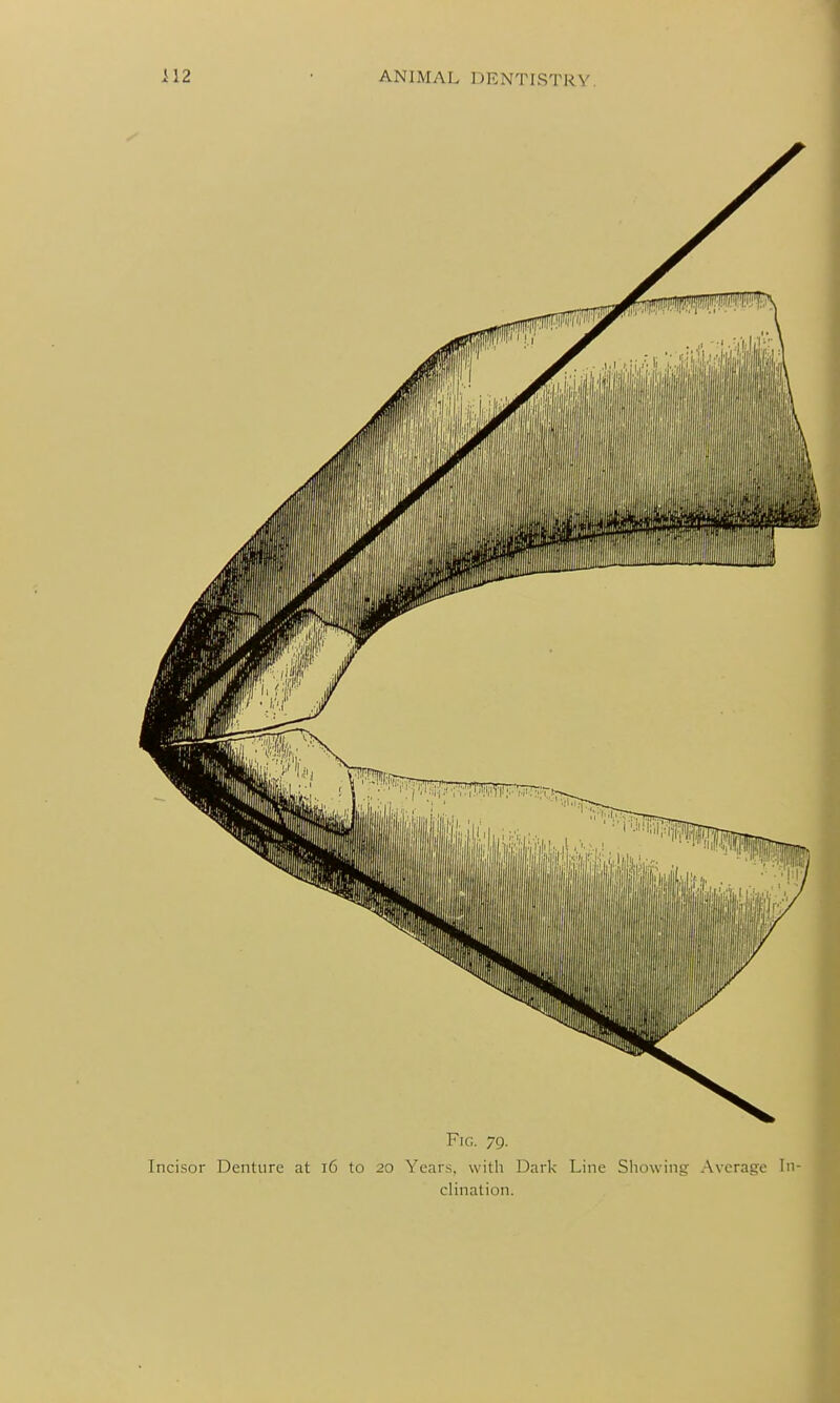 Ilii, Fig. 79. Incisor Denture at 16 to 20 Year.s, with Dark Line Sliowing Average In clination.