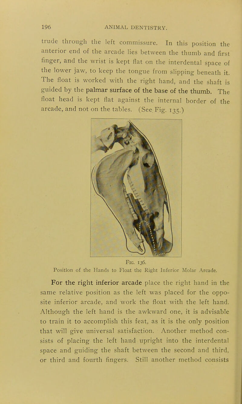 trudc through the left commissure. In this position the anterior end of the arcade lies between the thumb and first finger, and the wrist is kept flat on the interdental space of the lower jaw, to keep the tongue from slipping beneath it. The float is worked with the right hand, and the shaft is guided by the palmar surface of the base of the thumb. The float head is kept flat against the internal border of the arcade, and not on the tables. (See. Fig. 135.) Fig. 136. Position of tlie Hands to Float tlie Riglit Inferior Molar Arcade. For the right inferior arcade place the right hand in the same relative position as the left was placed for the oppo- site inferior arcade, and work the float with the left hand. Although the left hand is the awkward one, it is advisable to train it to accomplish this feat, as it is the only position that will give universal satisfaction. Another method con- sists of placing the left hand upright into the interdental space and guiding the shaft between the second and third, or third and fourth fingers. Still another method consists