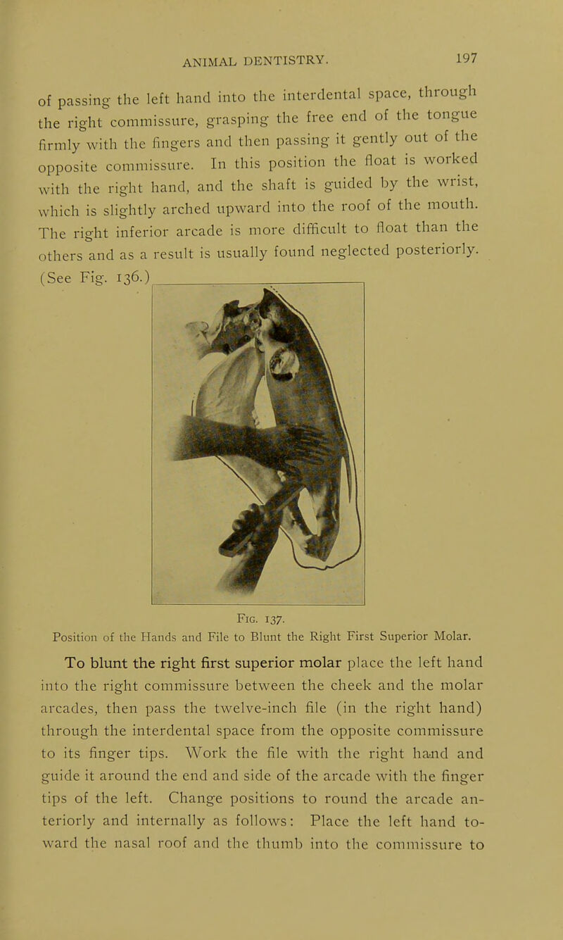 of passing the left hand hito the interdental space, through the right commissure, grasping the free end of the tongue firmly with the fingers and then passing it gently out of the opposite commissure. In this position the float is worked with the right hand, and the shaft is guided by the wrist, which is slightly arched upward into the roof of the mouth. The right inferior arcade is more difficult to float than the others and as a result is usually found neglected posteriorly. (See Fig. 136.) ^ Fig. 137. Position of the Hands and File to Blunt the Right First Superior Molar. To blunt the right first superior molar place the left hand into the right commissure between the cheek and the molar arcades, then pass the twelve-inch file (in the right hand) through the interdental space from the opposite commissure to its finger tips. Work the file with the right hand and guide it around the end and side of the arcade with the finger tips of the left. Change positions to round the arcade an- teriorly and internally as follows: Place the left hand to- ward the nasal roof and the thumb into the commissure to