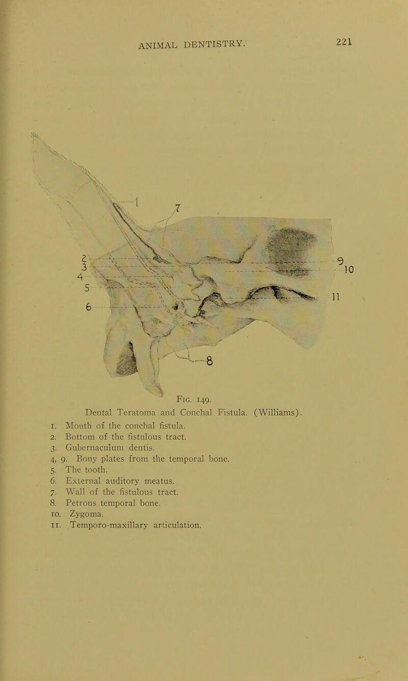 Fig. 149. Dental Teratoma and Concha! Fistula. (Williams). 1. Mouth of the conchal fistula. 2. Bottom of the fistulous tract. 3. Gubernaculum dentis. 4. 9. Bony plates from the temporal bone. 5. The tooth. 6. External auditory meatus. 7. Wall of the fistulous tract. 8. Petrous temporal bone. 10. Zygoma. 11. Temporo-maxillary articulation.