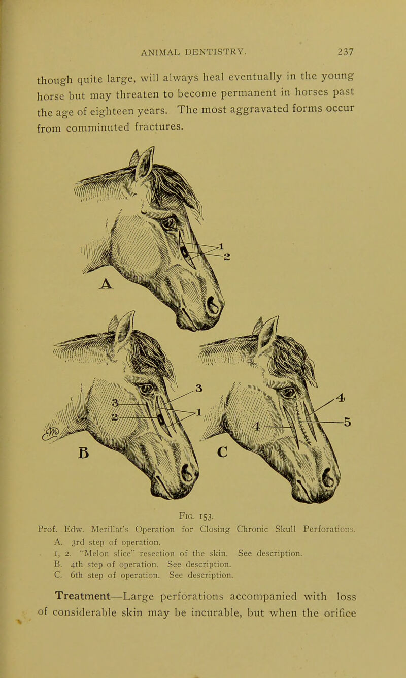 though quite large, will always heal eventually in the young horse but may threaten to become permanent in horses past the age of eighteen years. The most aggravated forms occur from comminuted fractures. Fig. 153. Prof. Edw. Mcrillat's Operation for Closing Chronic Skull Perforations. A. 3rcl step of operation. I, 2. Melon slice resection of tlie skin. See description. B. 4th step of operation. See description. C. 6th step of operation. See description. Treatment—Large perforations accompanied with loss of considerable skin may be incurable, but when the orifice